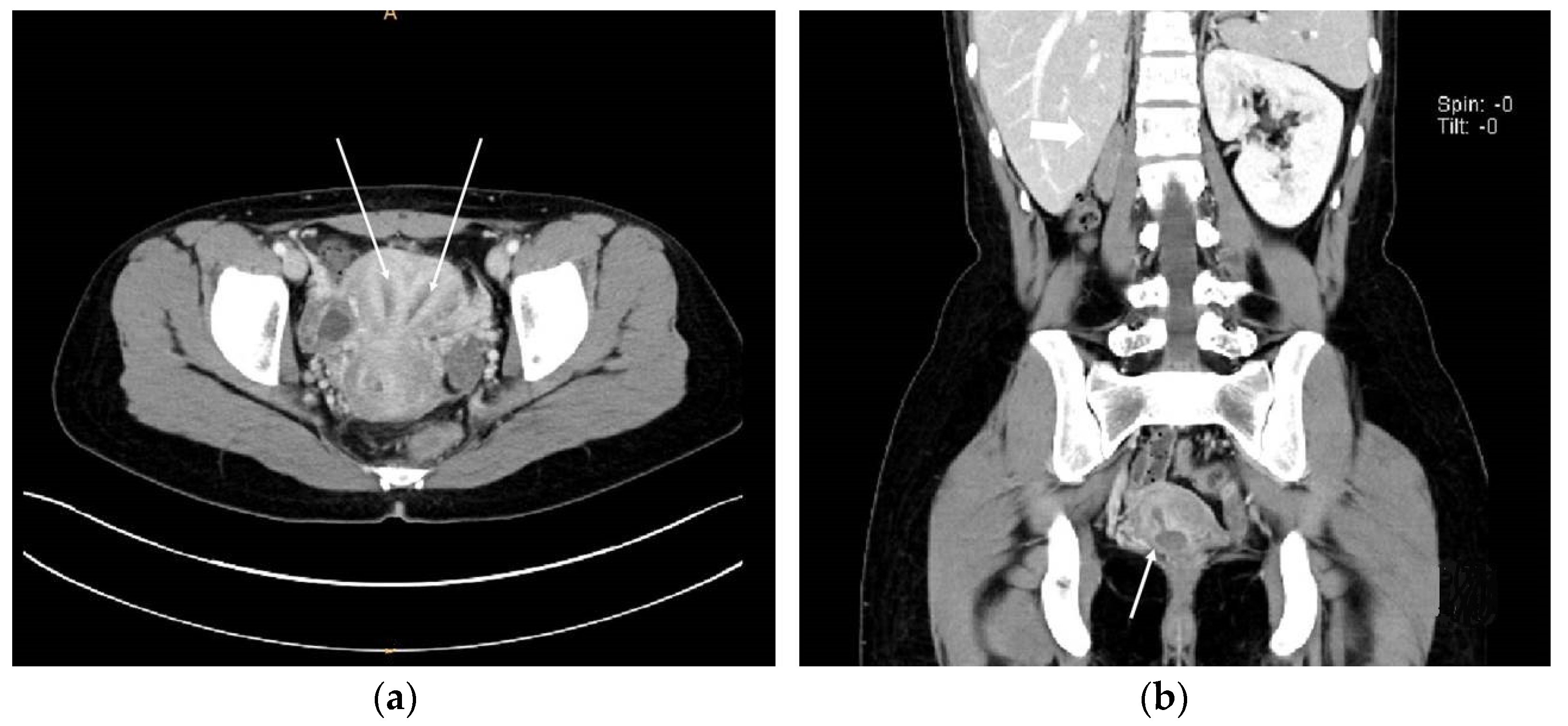 Surgeries 04 00002 g003