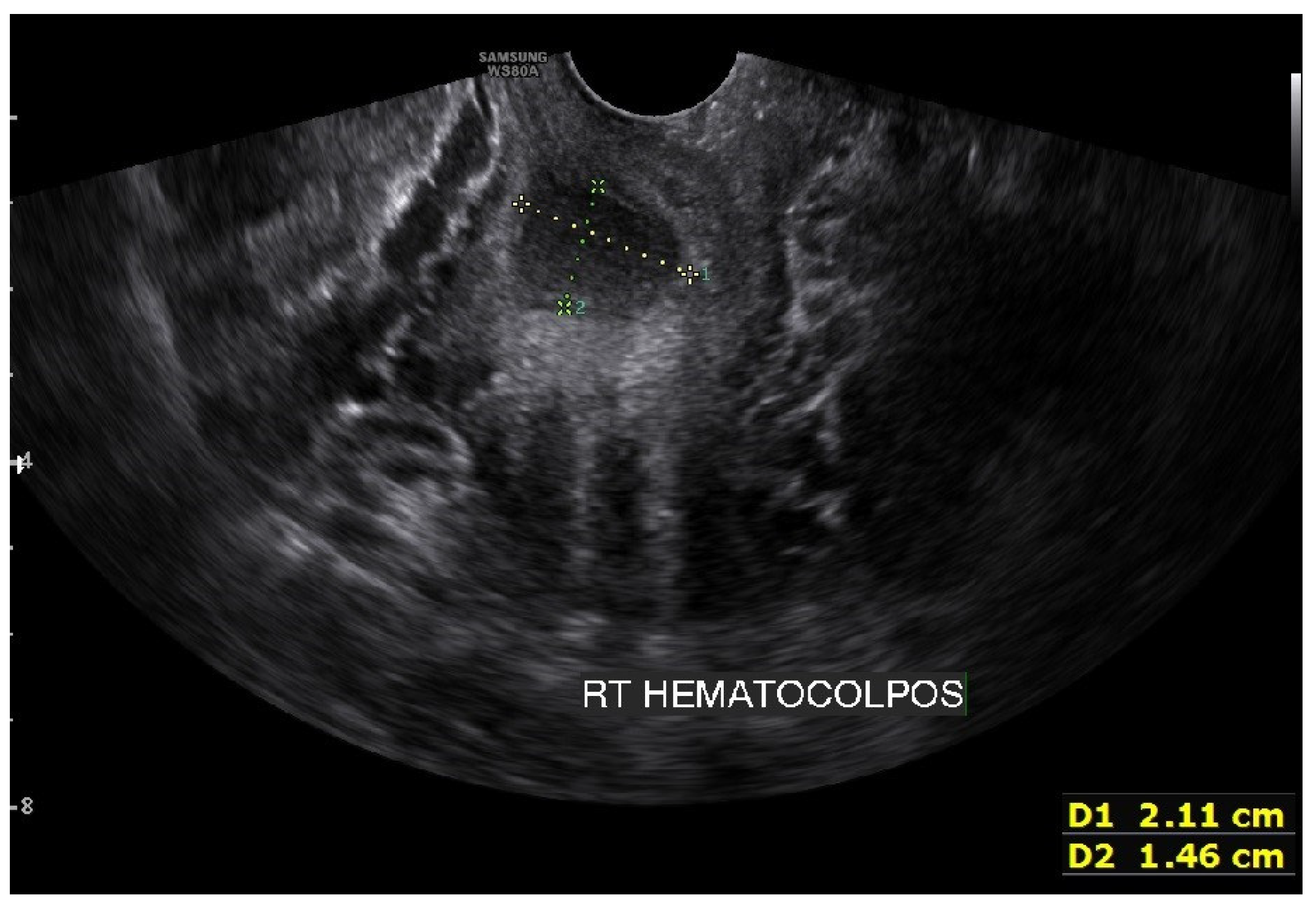 Surgeries 04 00002 g004
