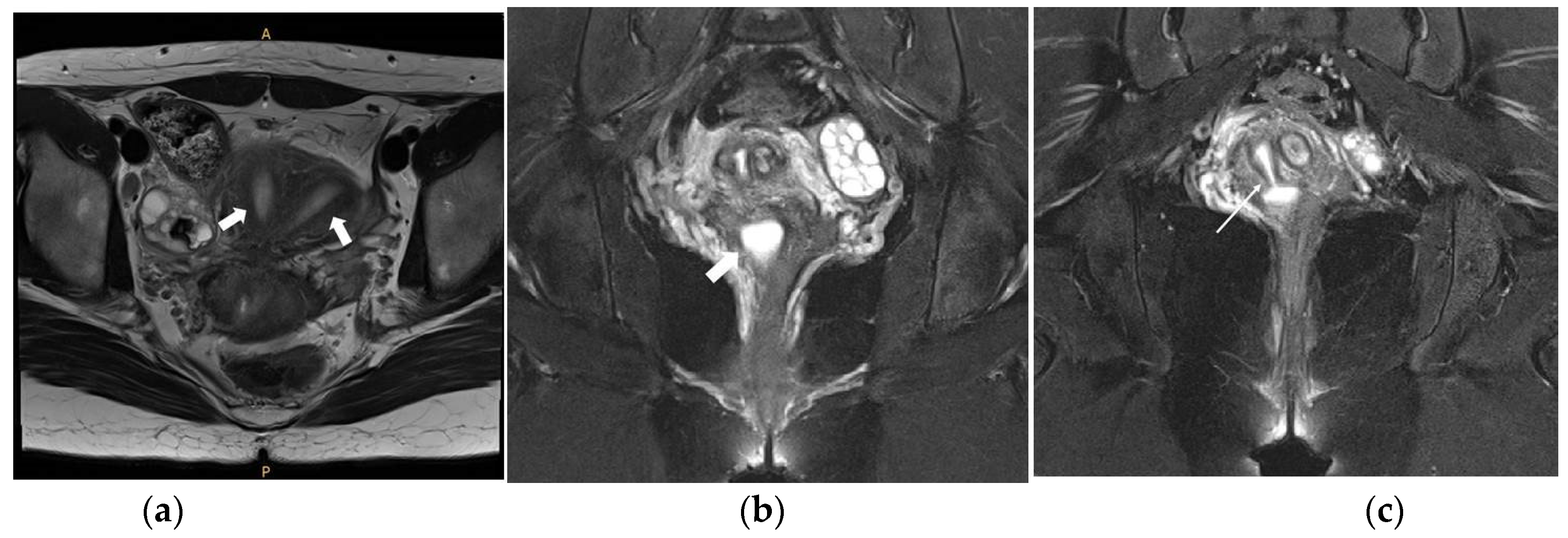 Surgeries 04 00002 g005