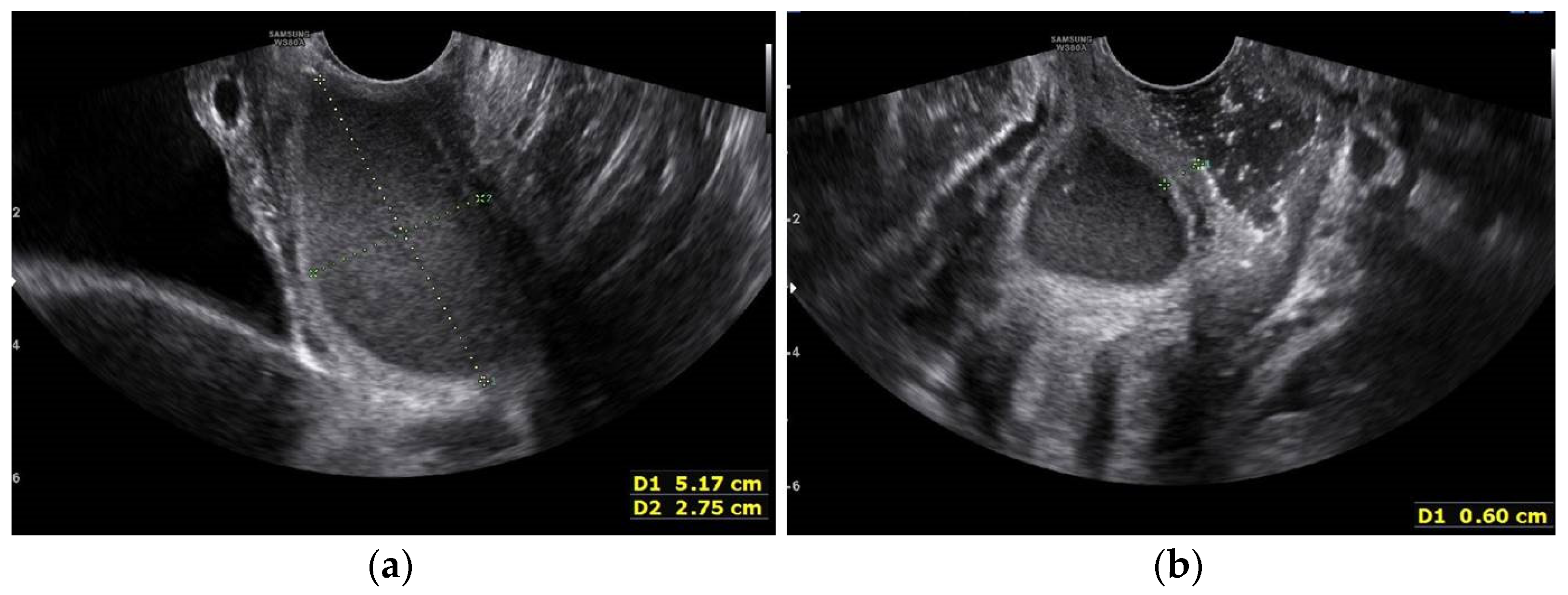 Surgeries 04 00002 g006