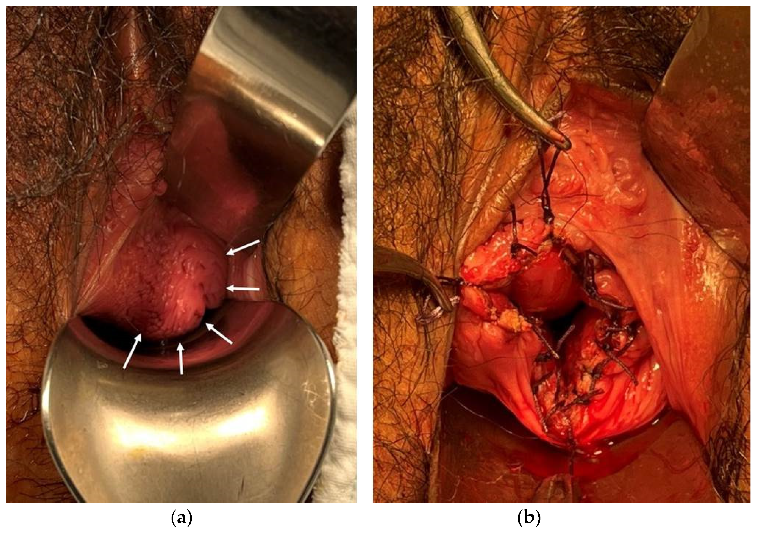 Surgeries 04 00002 g007