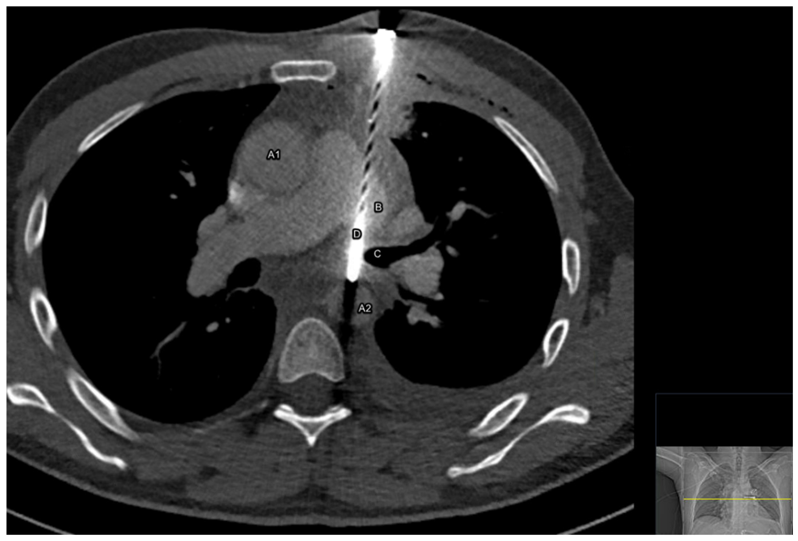 Surgeries 04 00006 g001
