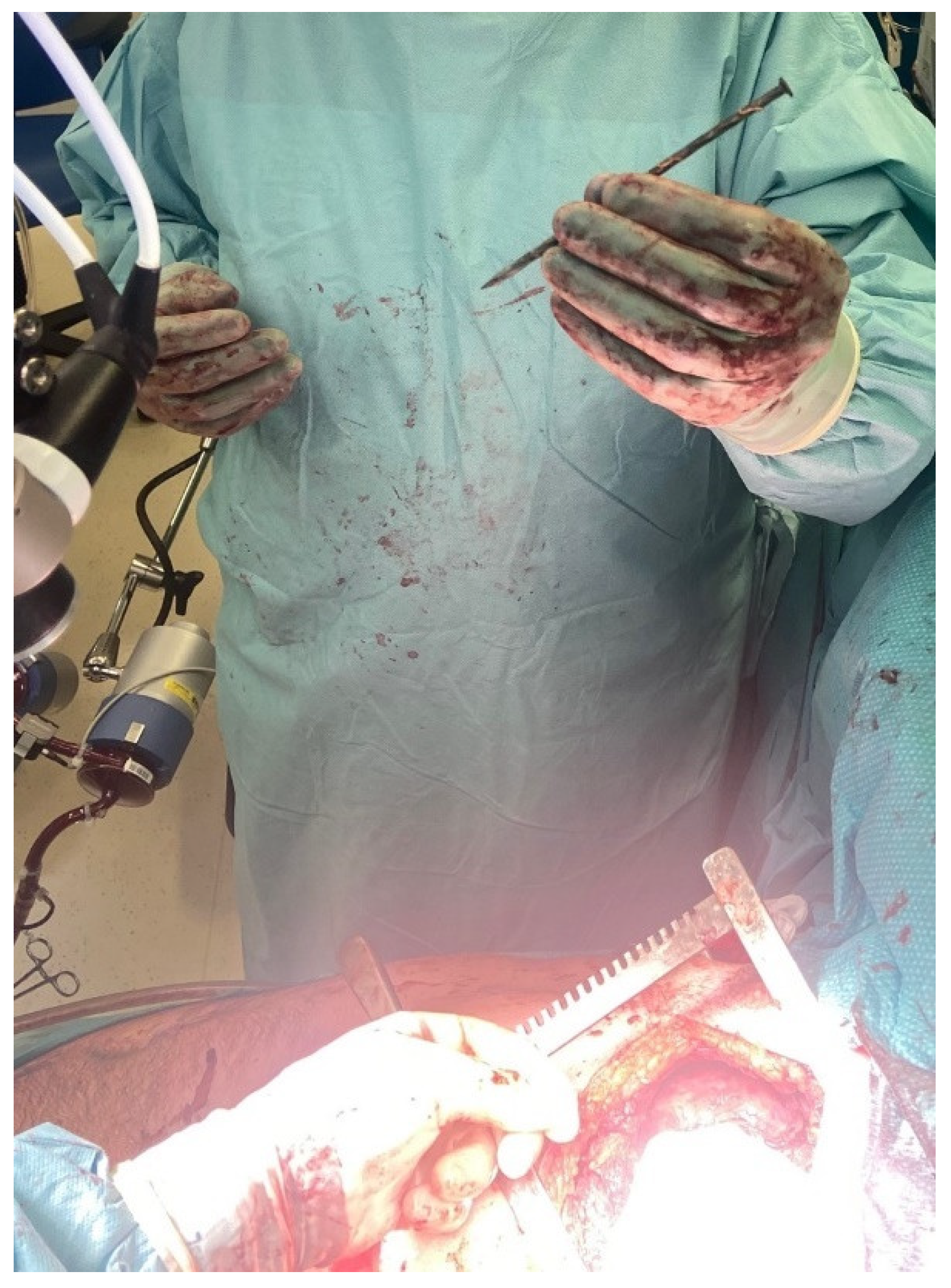 Surgeries 04 00006 g003