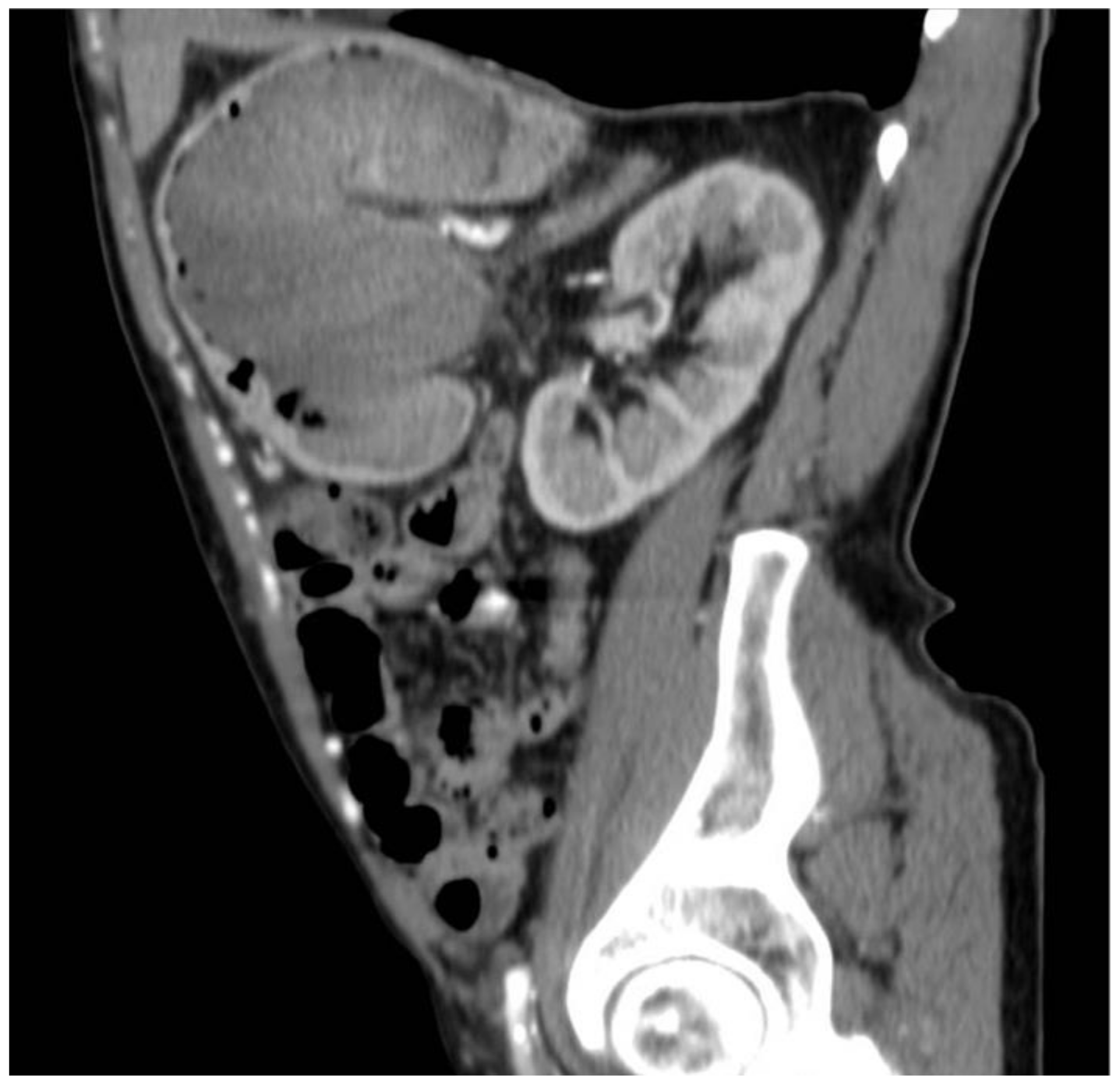 Surgeries 04 00009 g004