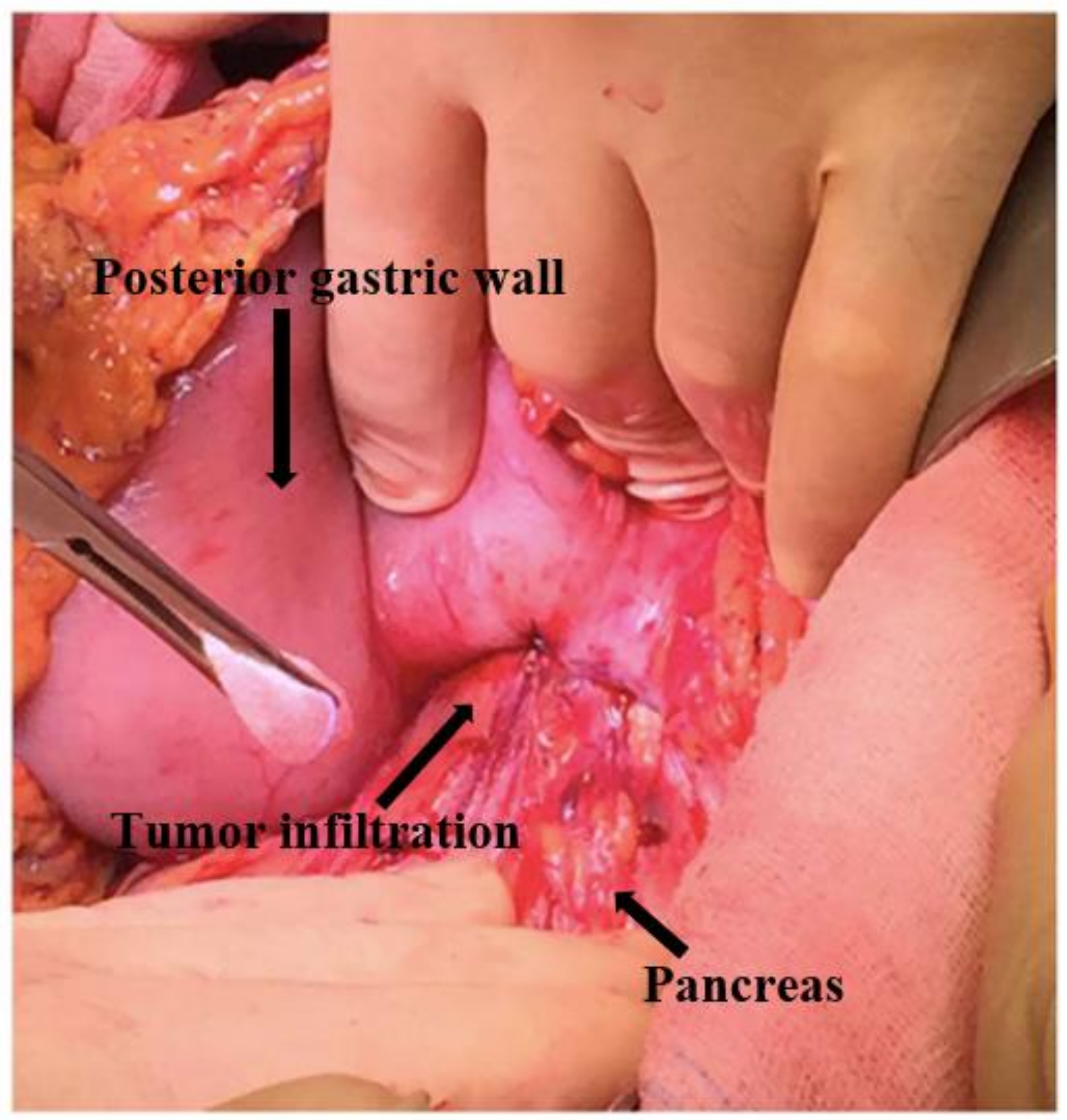 Surgeries 04 00009 g007