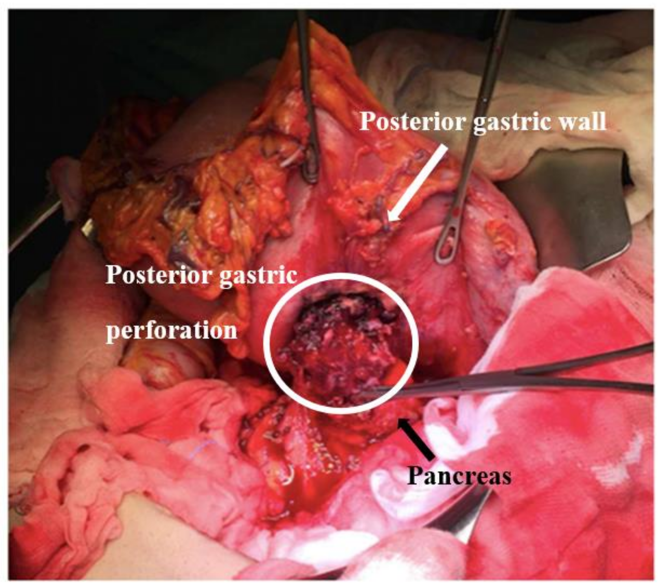 Surgeries 04 00009 g008