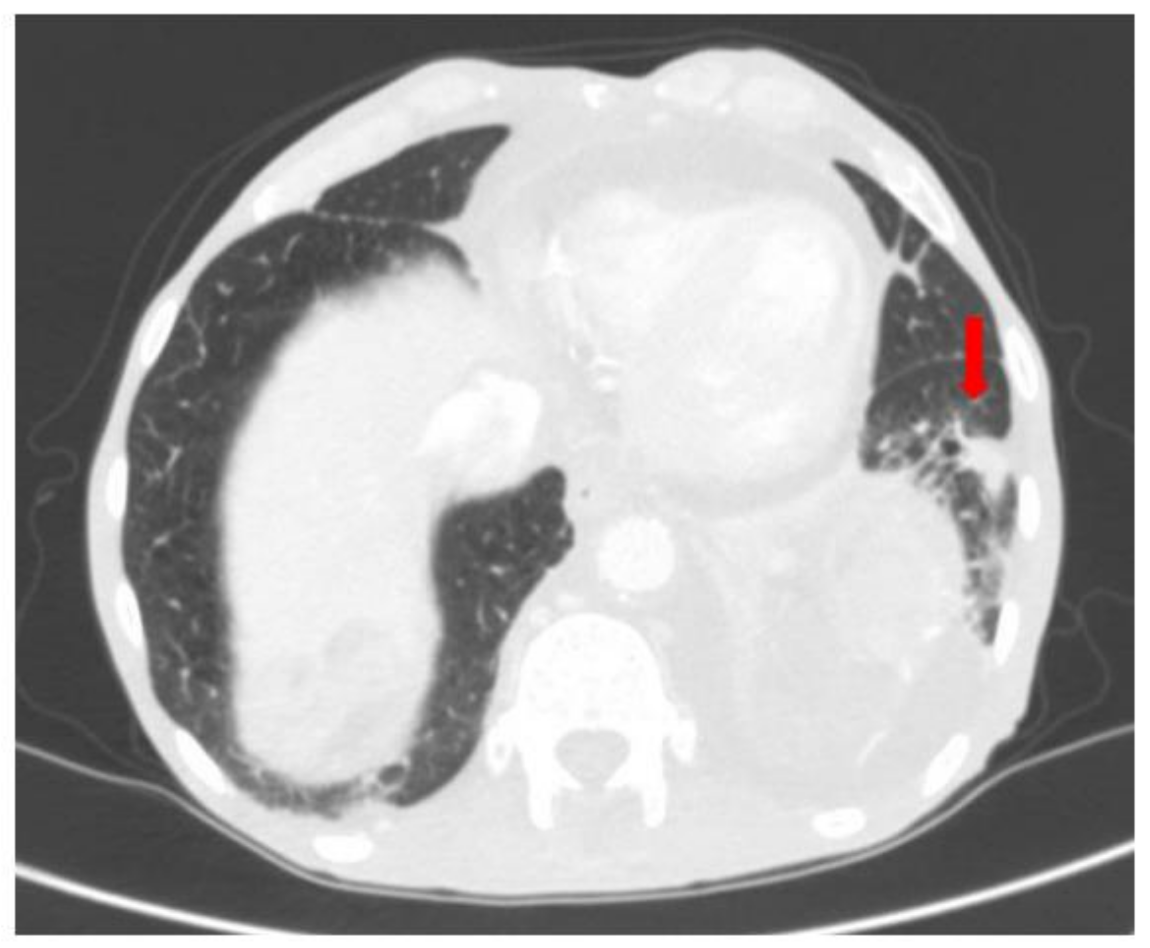 Surgeries 04 00009 g013