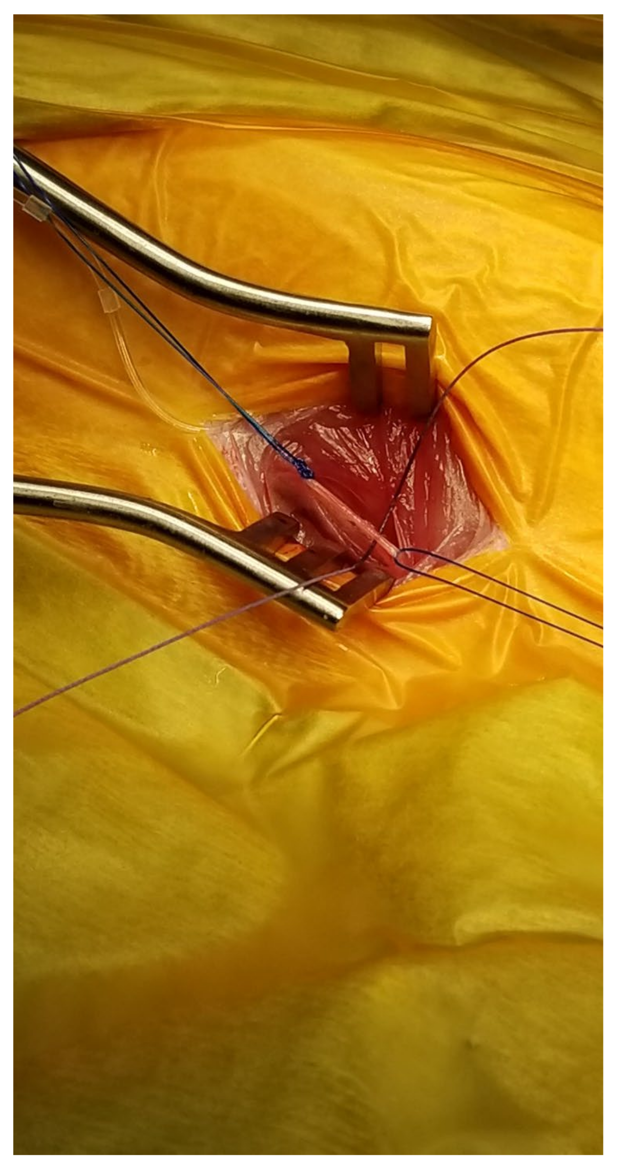 Surgeries 04 00016 g002