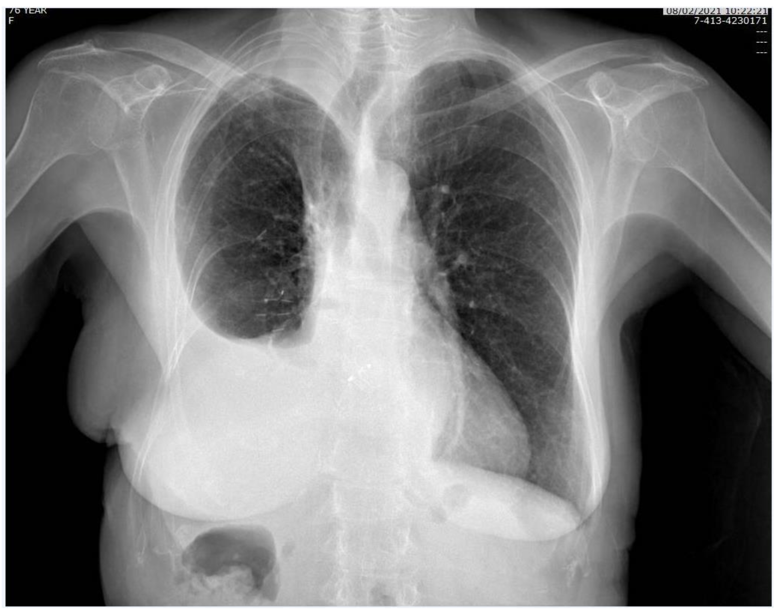 Surgeries 04 00018 g003 Surgeries 04 00018 g003