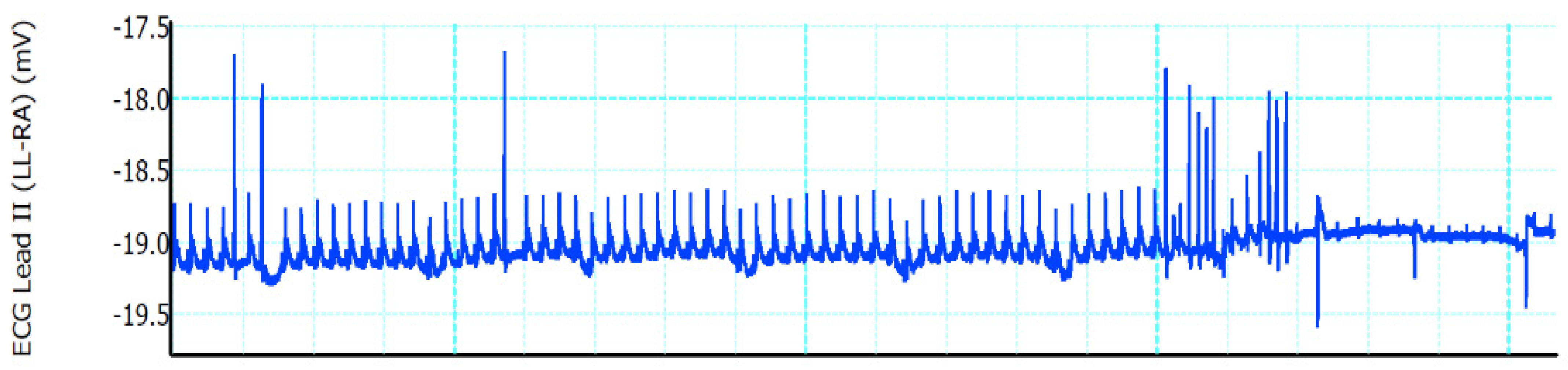 Surgeries 04 00020 g002 Surgeries 04 00020 g002