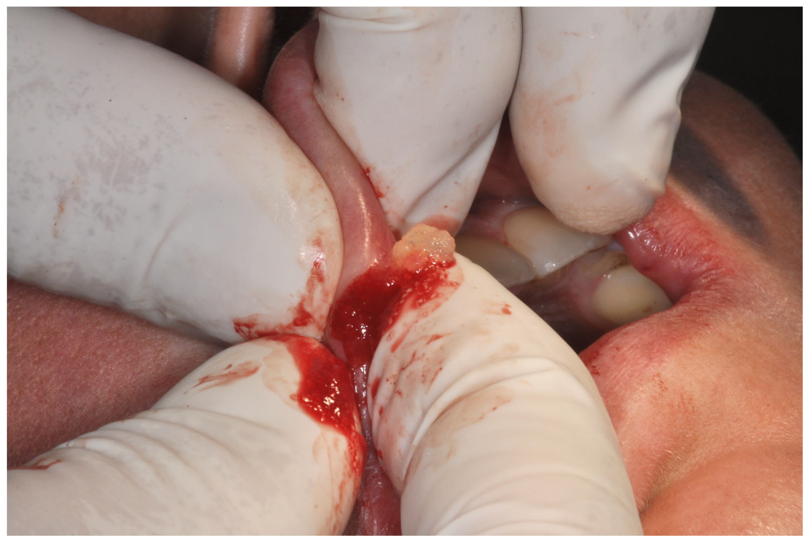 Surgeries 04 00023 g003