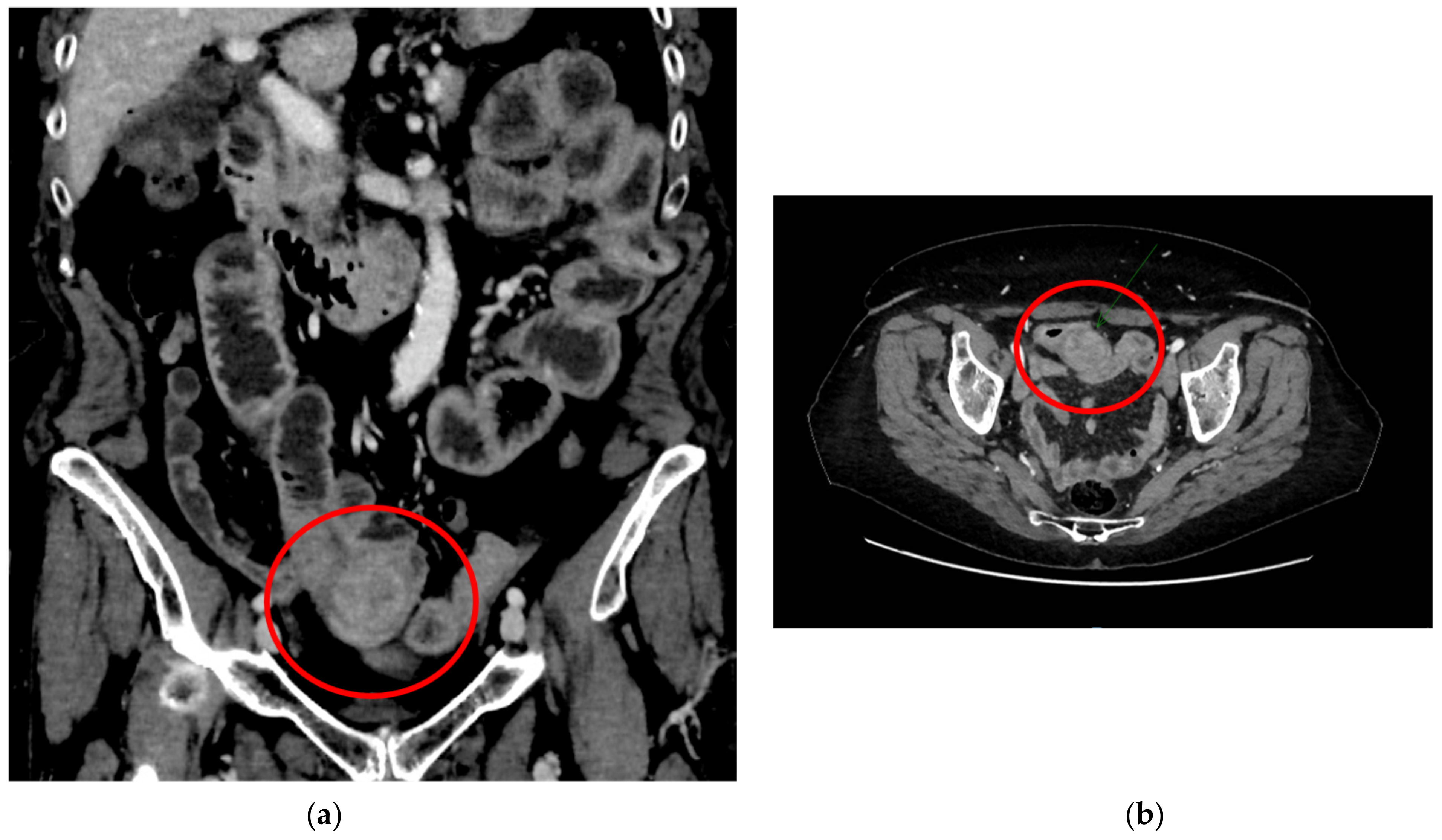 Surgeries 04 00024 g001