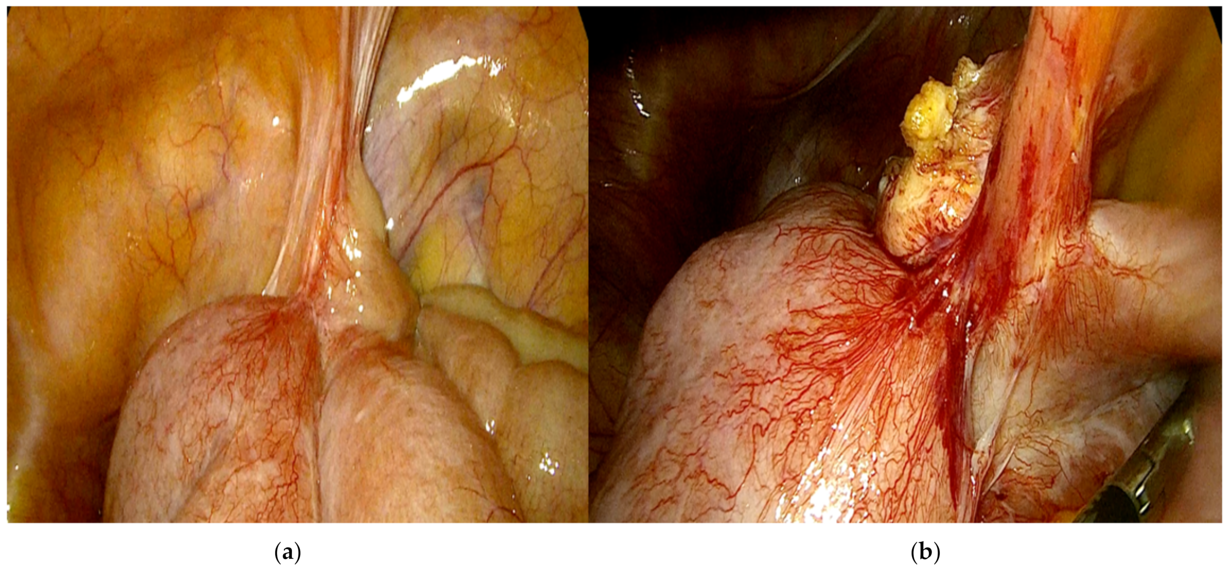 Surgeries 04 00024 g003