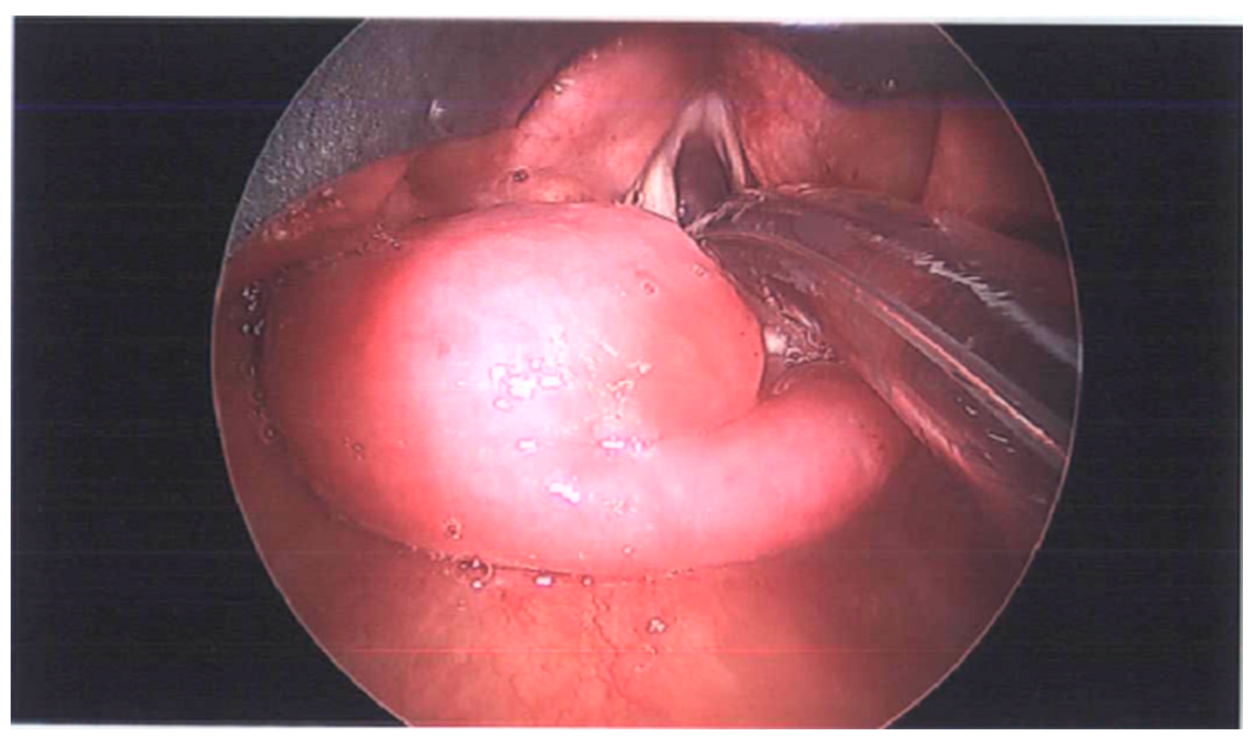 Surgeries 04 00028 g001