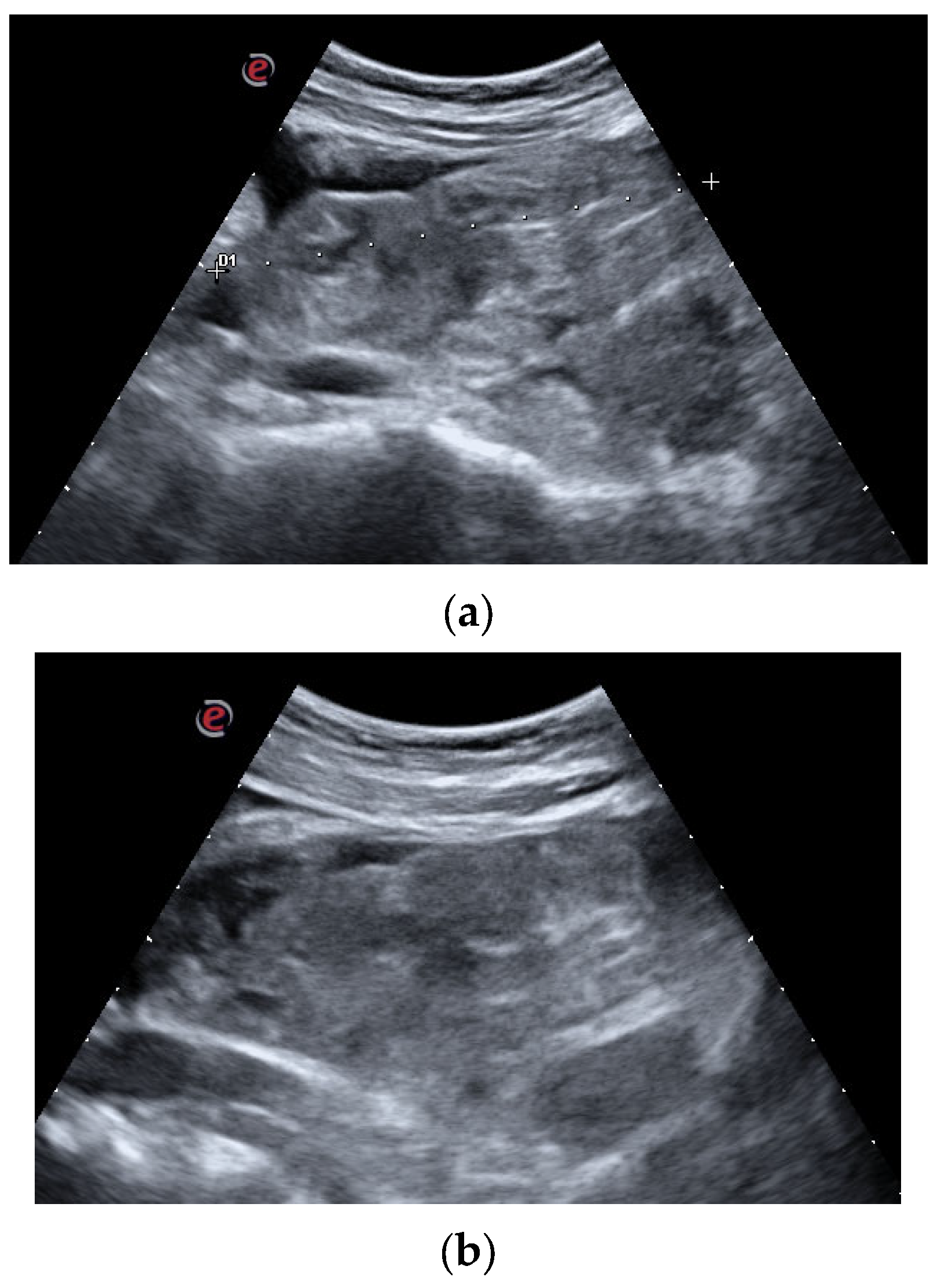 Surgeries 04 00030 g001
