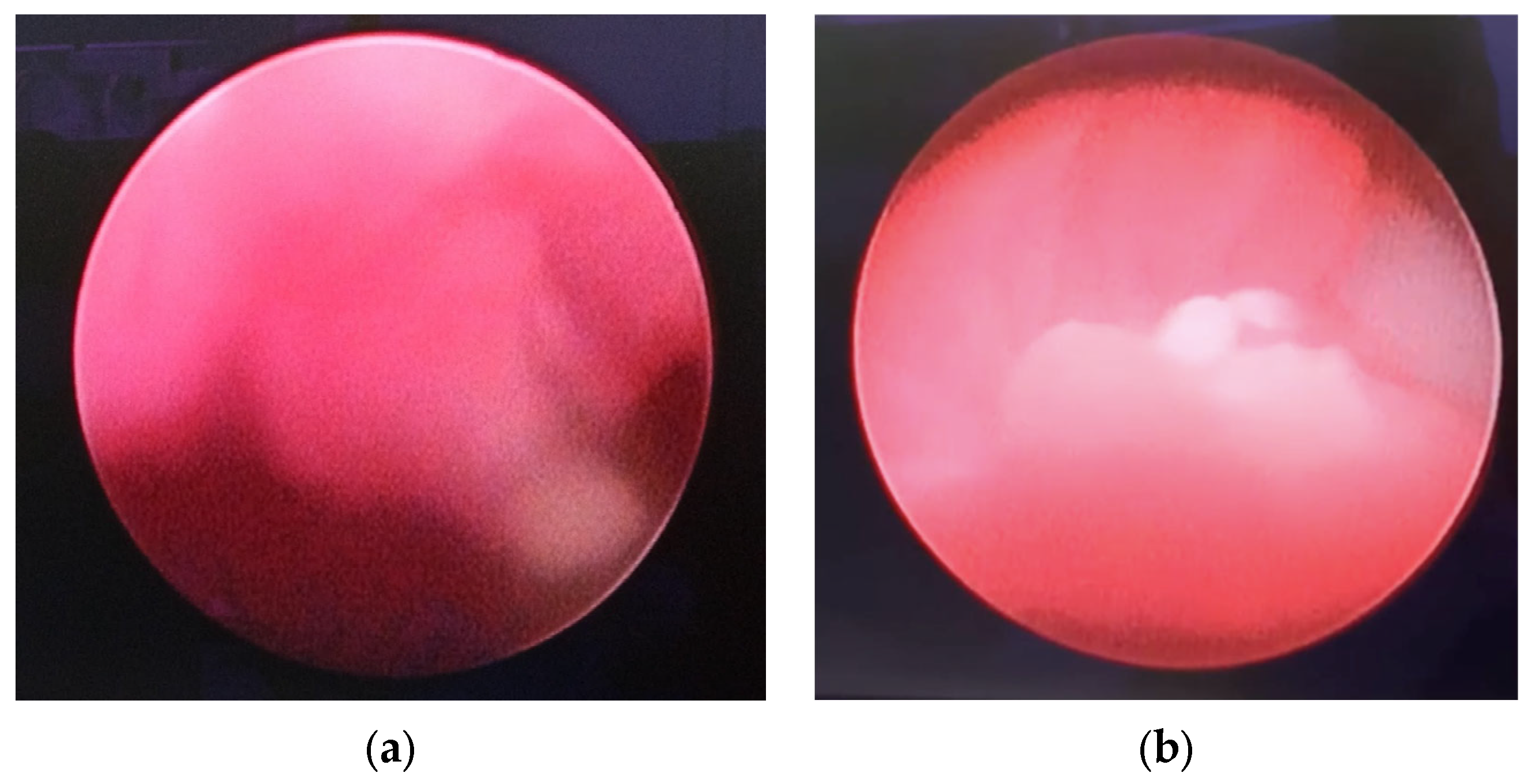 Surgeries 04 00030 g002