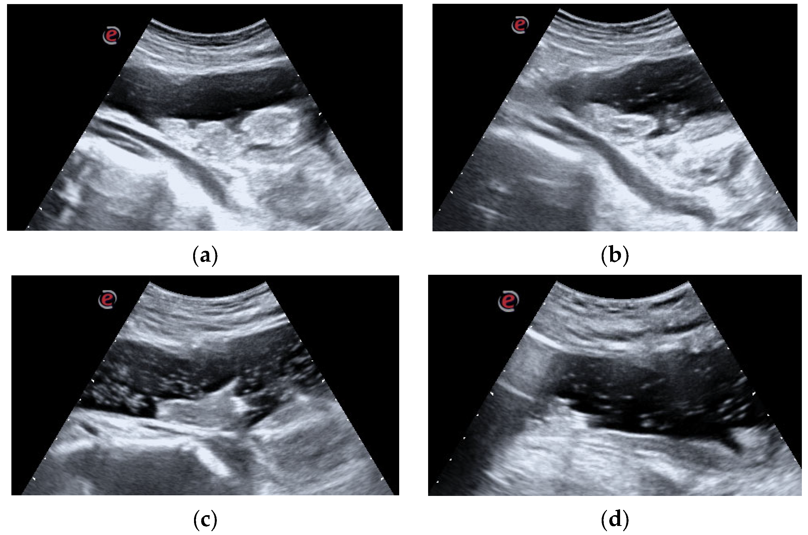 Surgeries 04 00030 g004