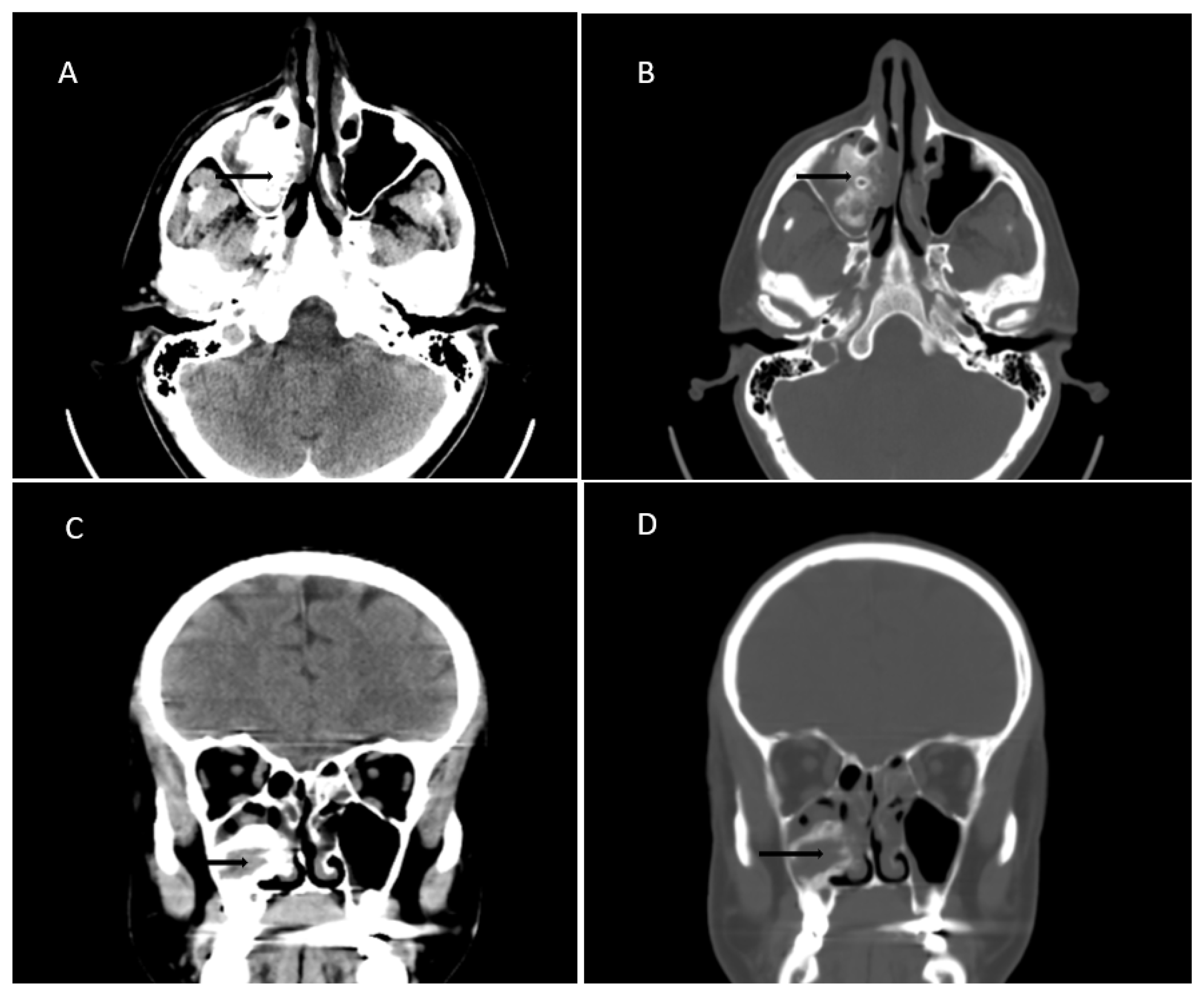 Surgeries 04 00032 g001