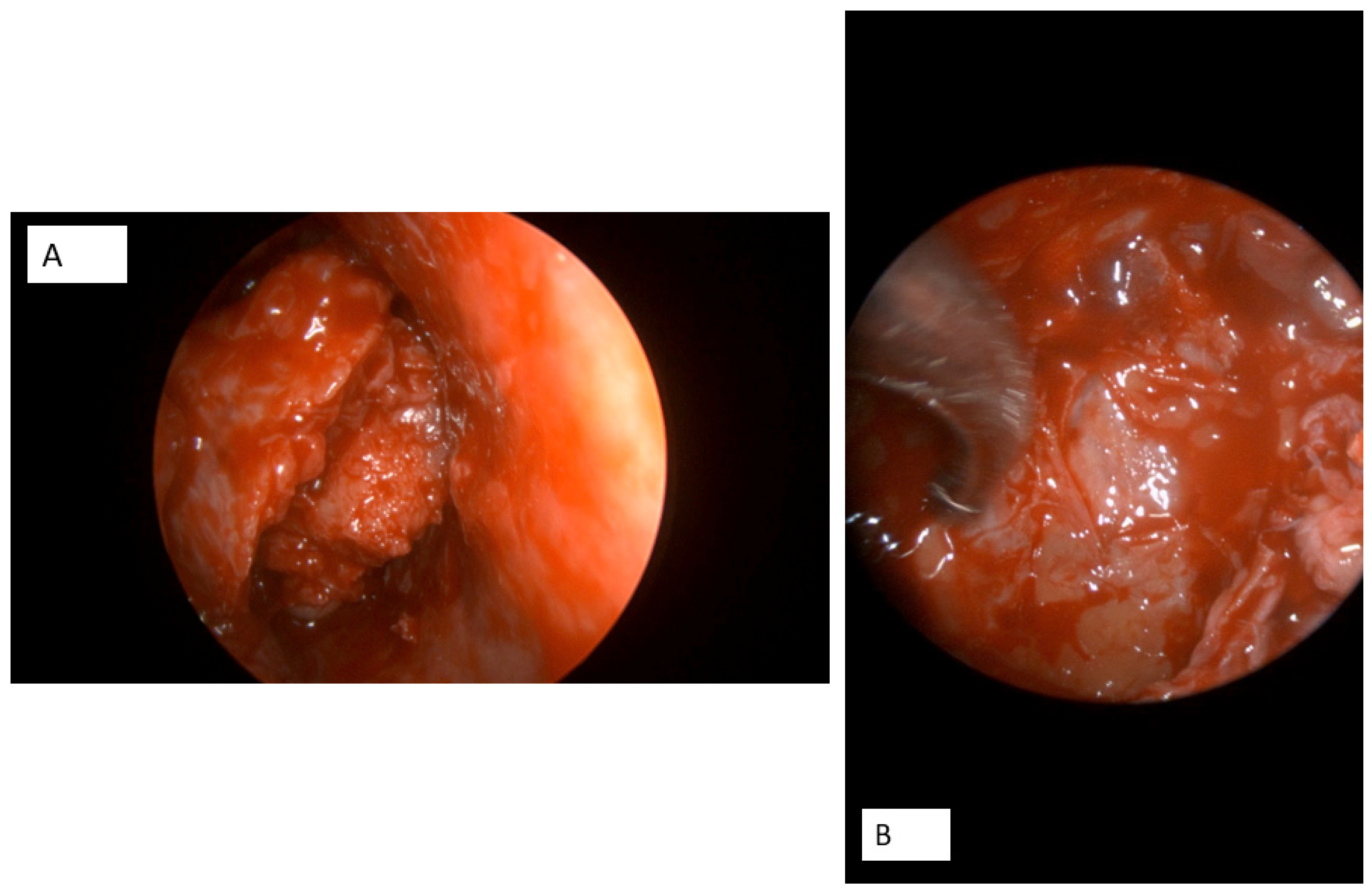 Surgeries 04 00032 g002