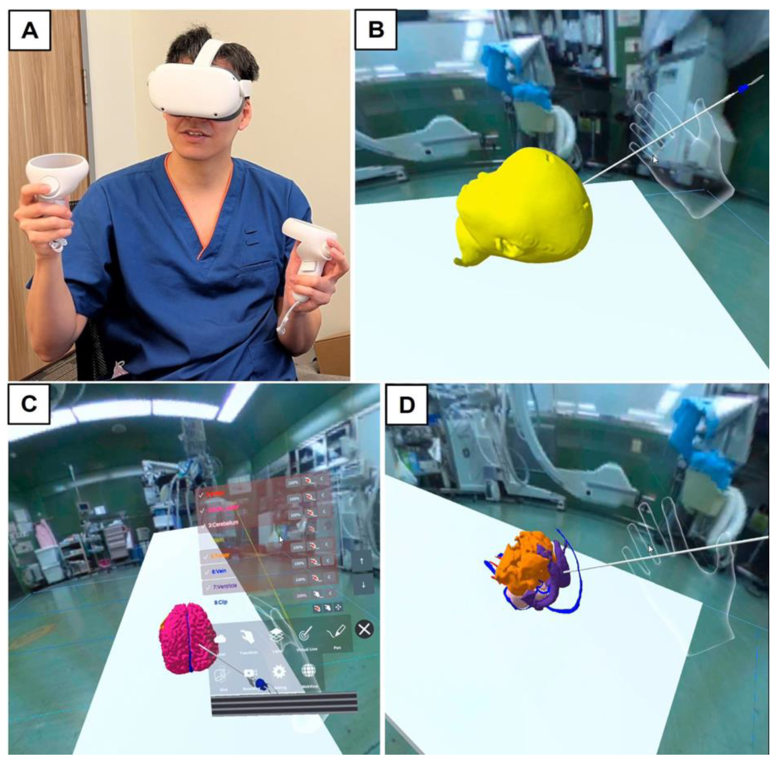 Surgeries 04 00036 g002