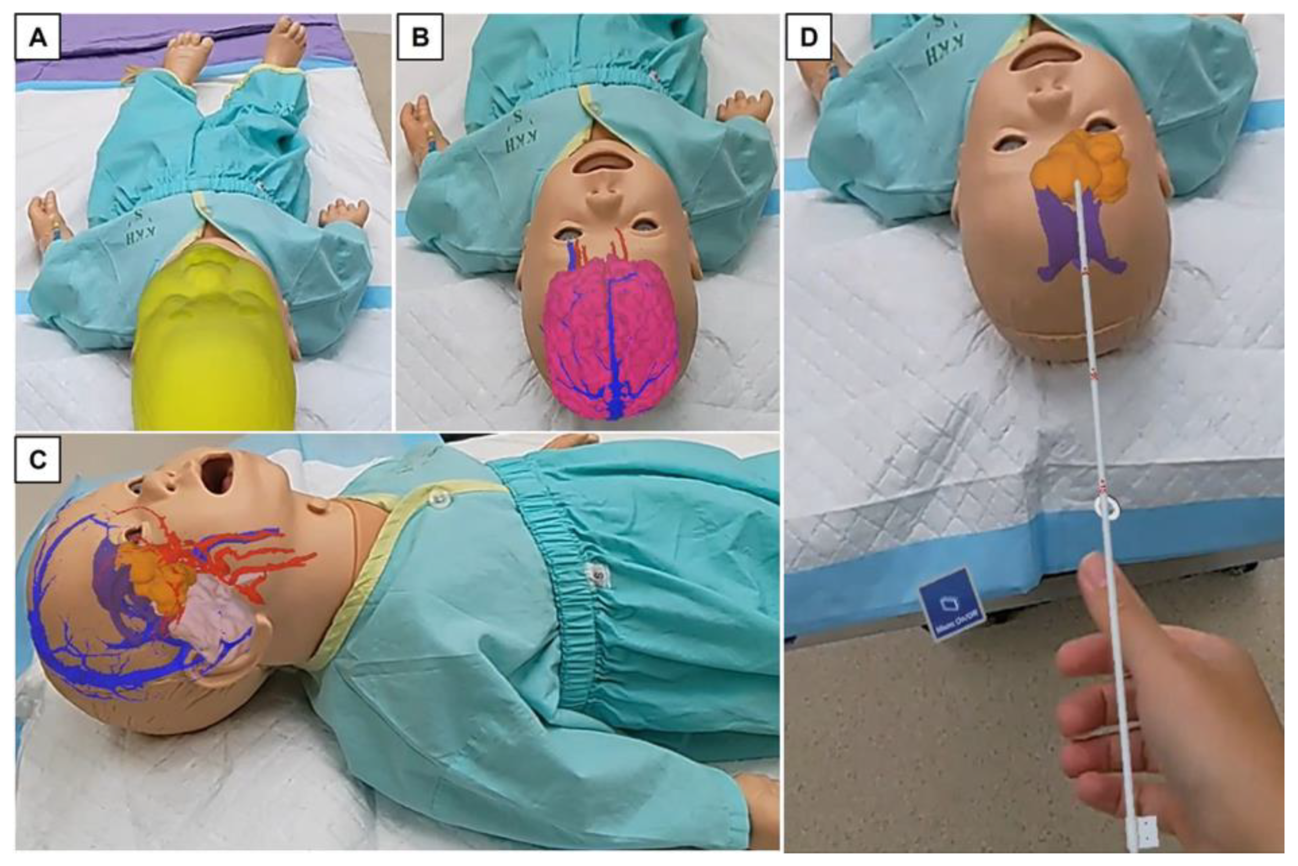 Surgeries 04 00036 g003