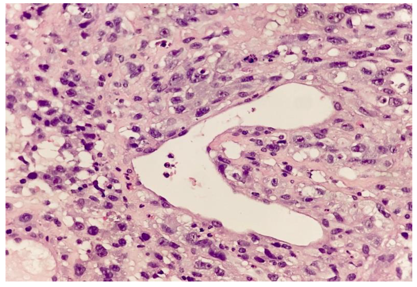 Surgeries 04 00038 g006 Surgeries 04 00038 g006