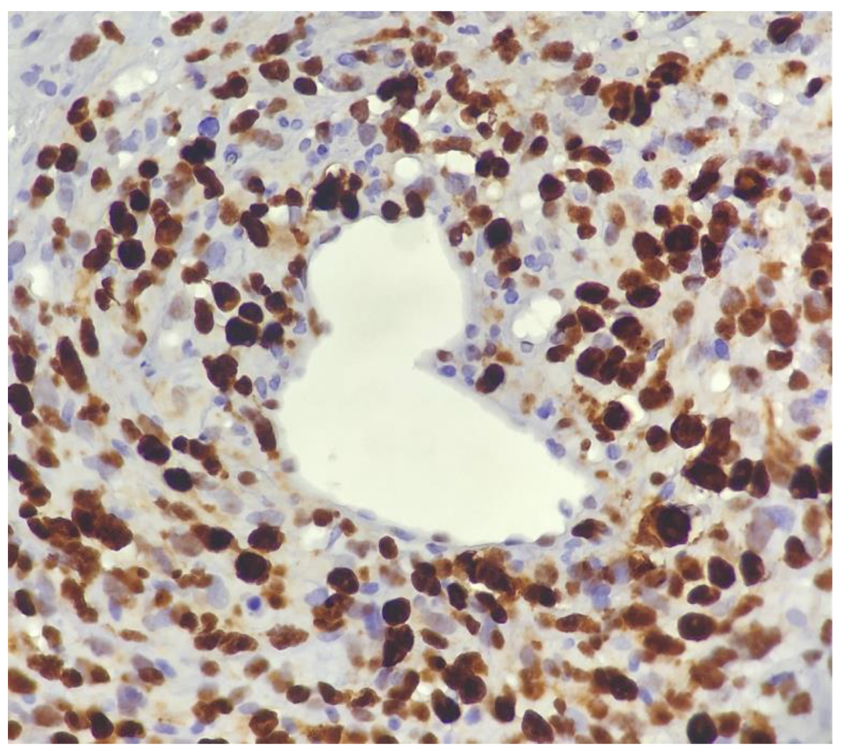 Surgeries 04 00038 g007 Surgeries 04 00038 g007