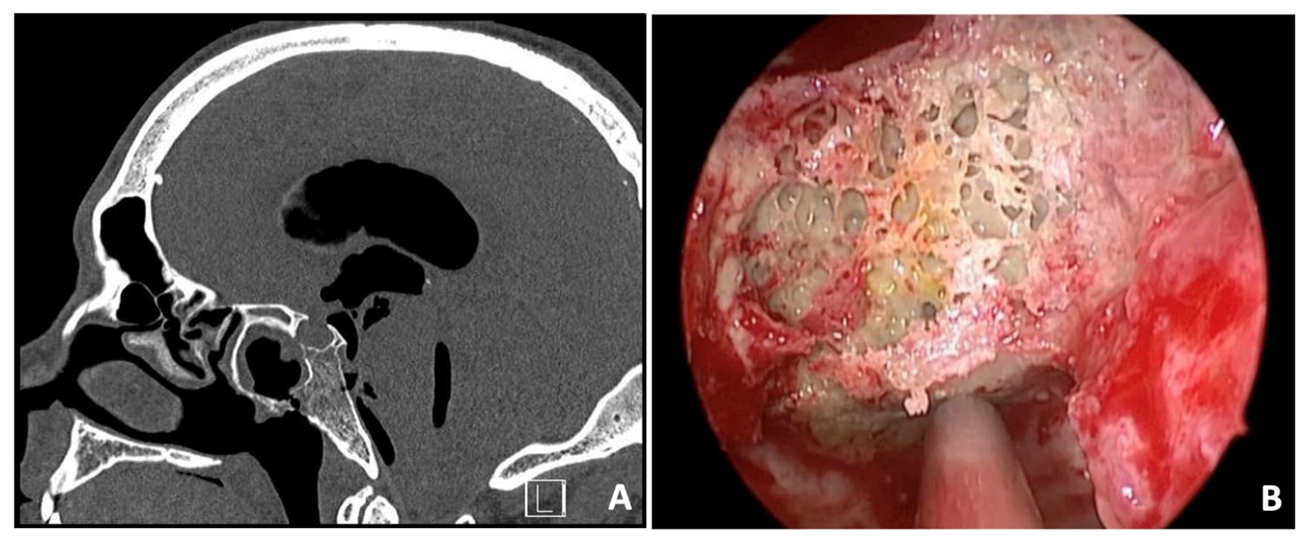 Surgeries 04 00042 g001 Surgeries 04 00042 g001