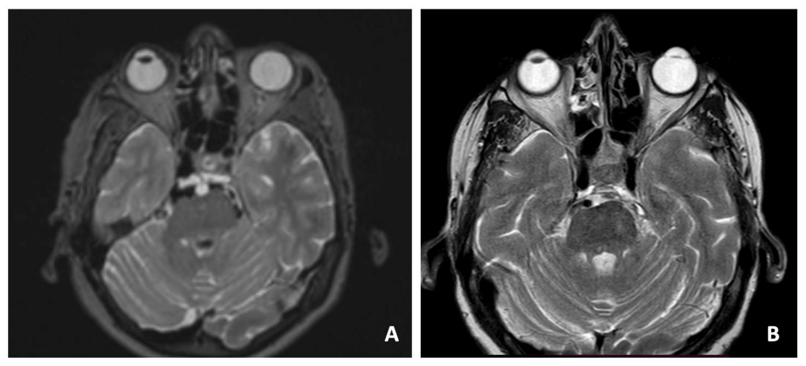 Surgeries 04 00042 g002 Surgeries 04 00042 g002