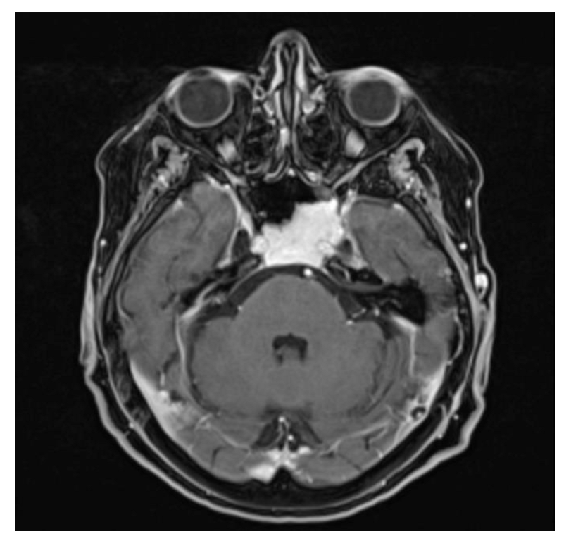 Surgeries 04 00042 g004 Surgeries 04 00042 g004