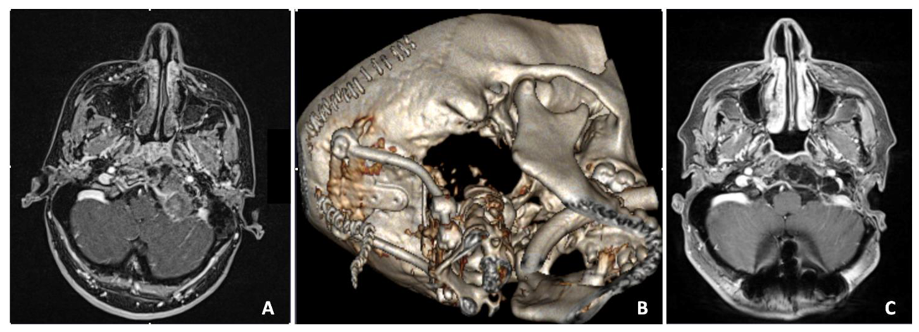 Surgeries 04 00042 g005 Surgeries 04 00042 g005