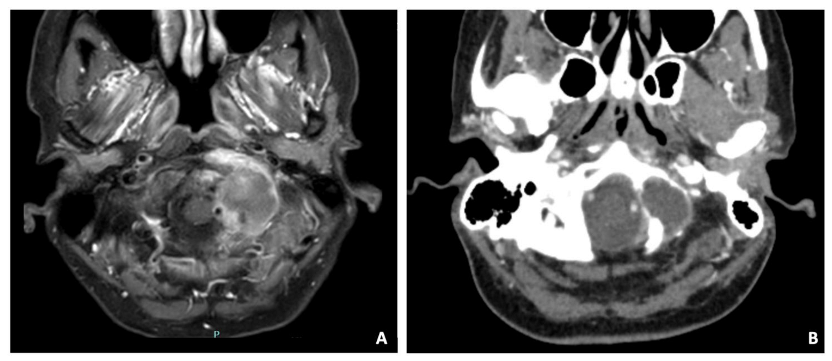 Surgeries 04 00042 g007 Surgeries 04 00042 g007
