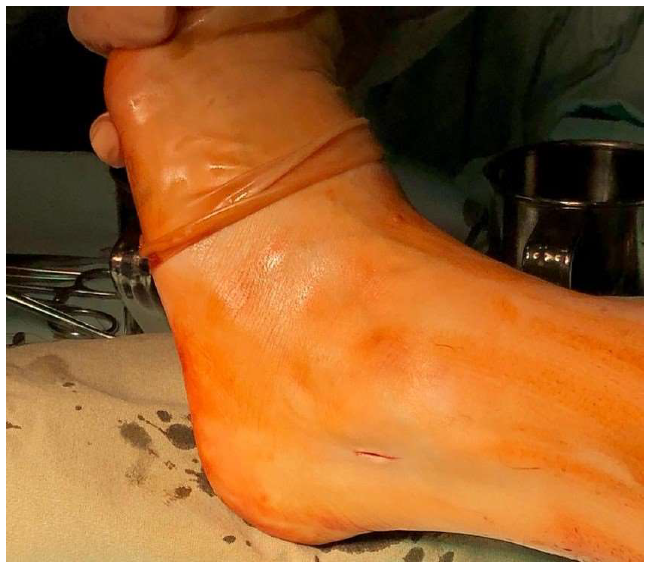 Surgeries 04 00043 g001