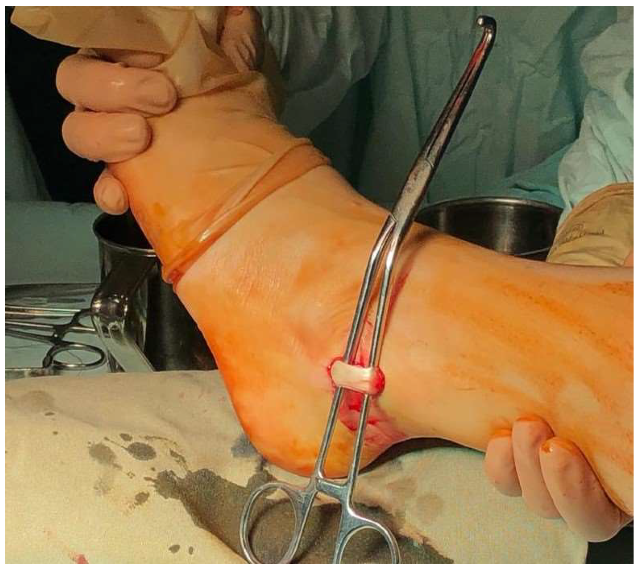 Surgeries 04 00043 g002