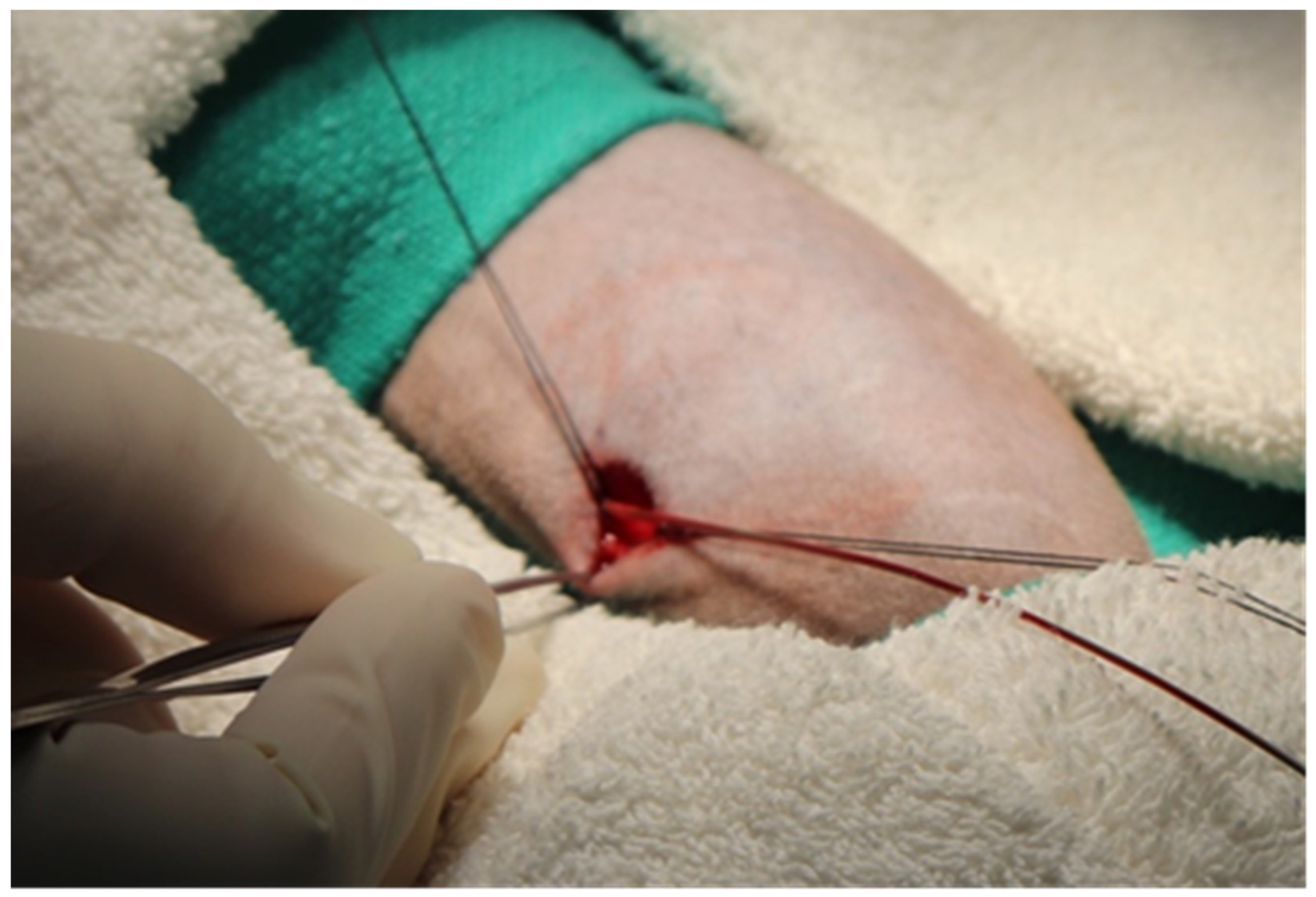 Surgeries 04 00044 g003