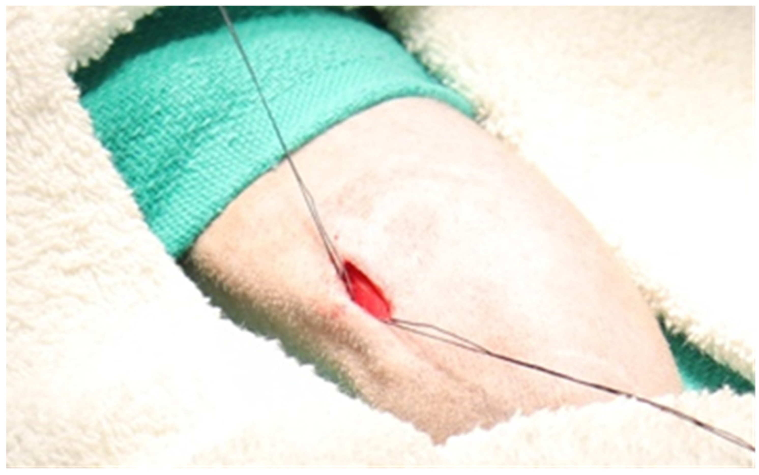 Surgeries 04 00044 g004