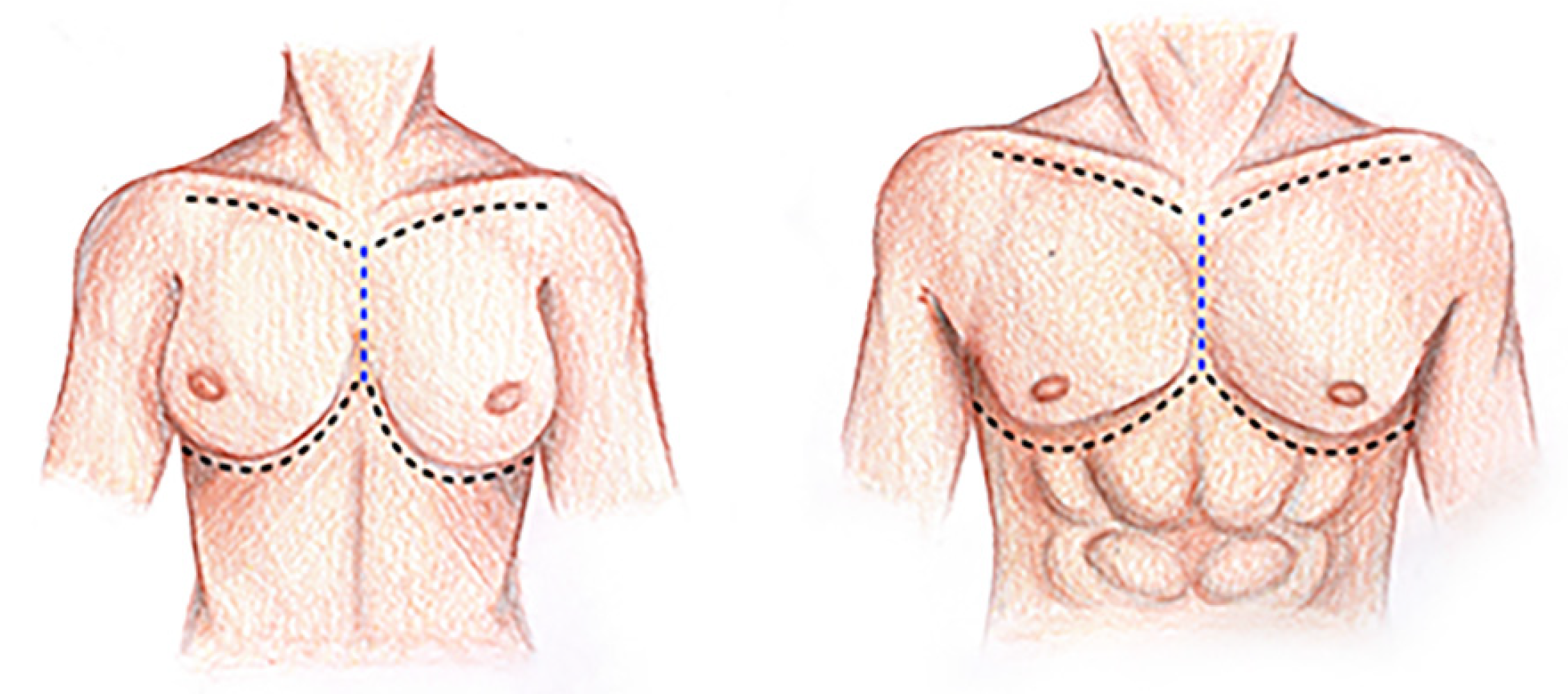 Surgeries 04 00046 g001