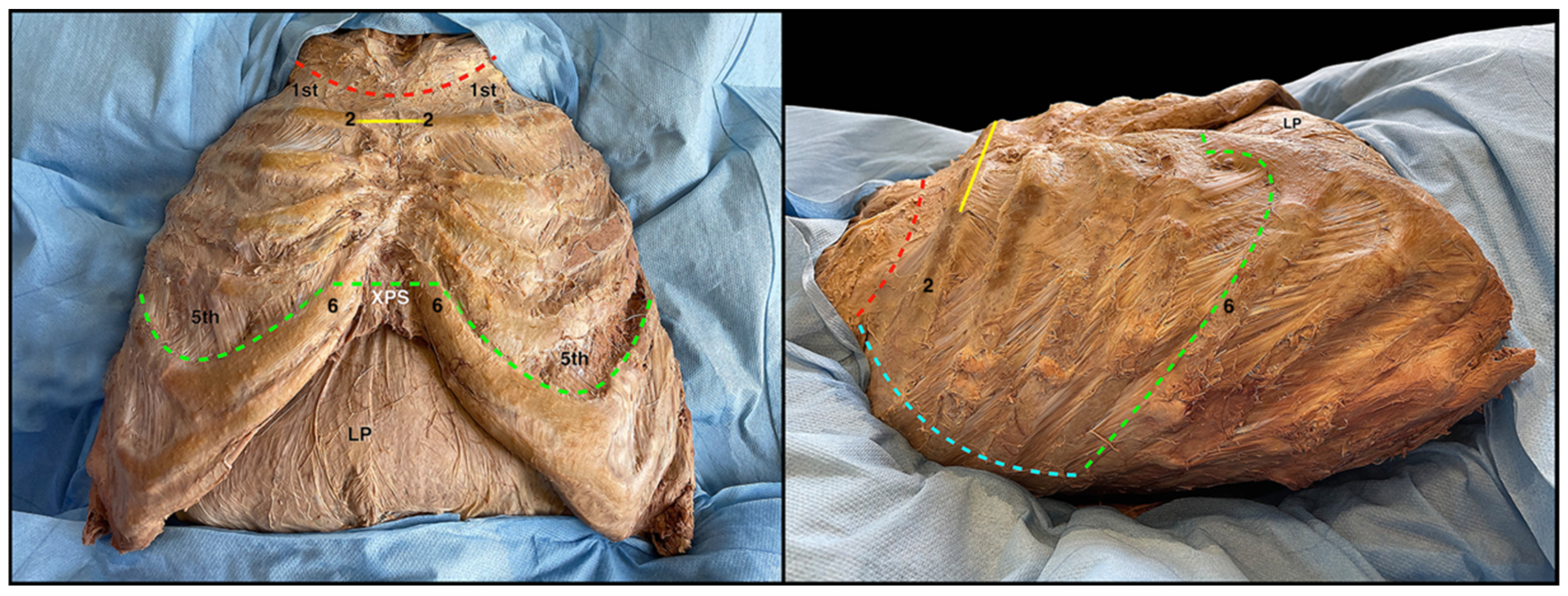 Surgeries 04 00046 g002