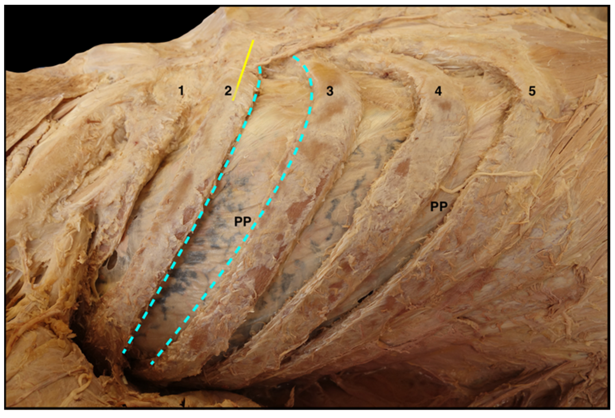 Surgeries 04 00046 g003