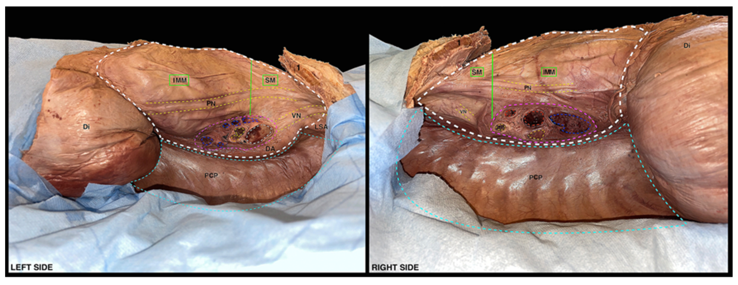 Surgeries 04 00046 g005