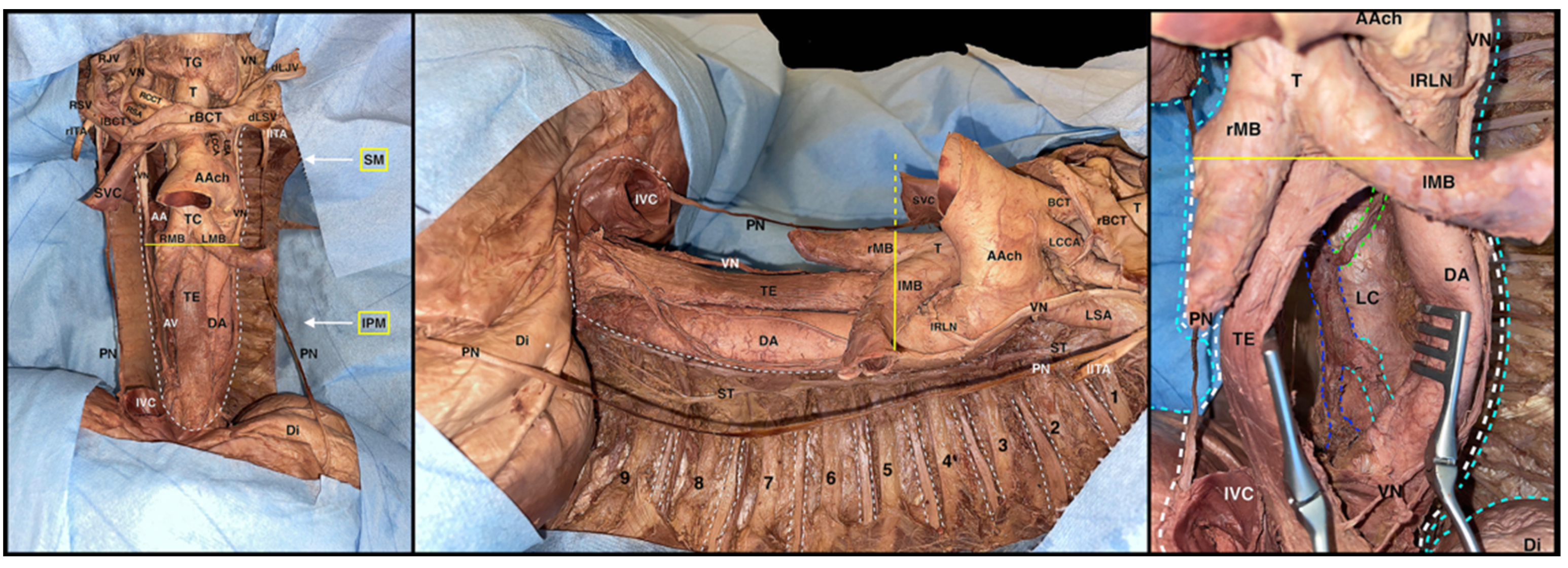 Surgeries 04 00046 g008