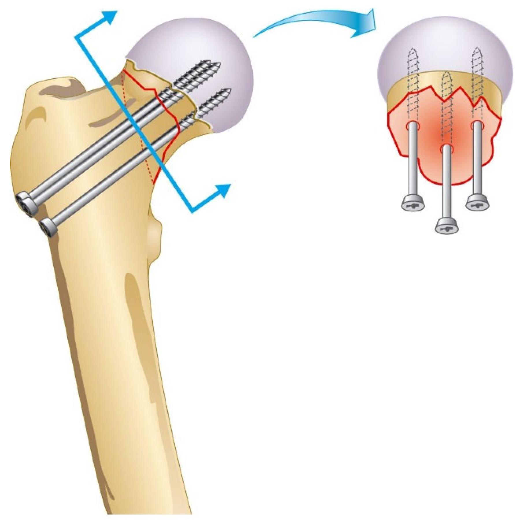 Surgeries 04 00048 g001