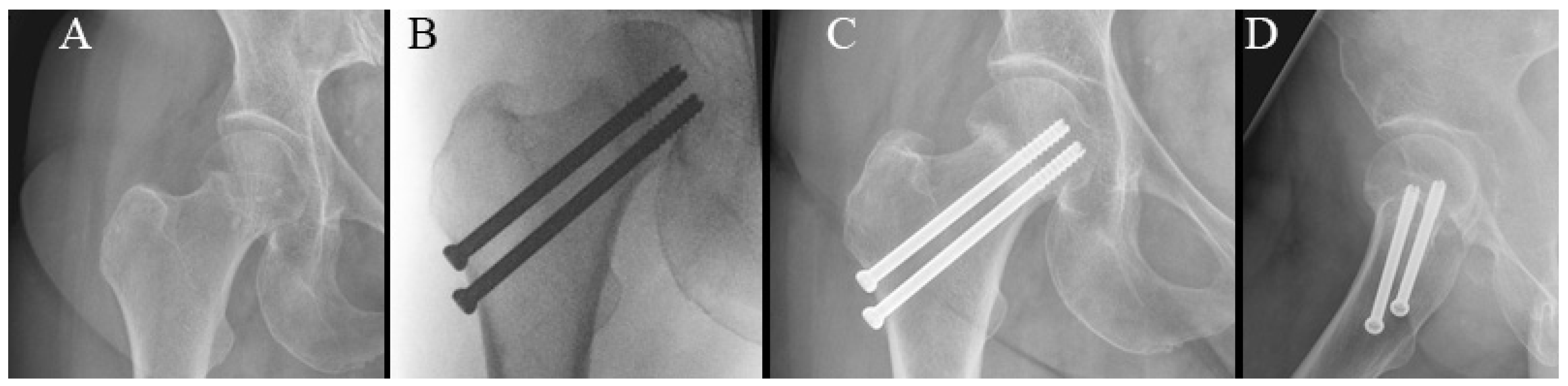 Surgeries 04 00048 g004