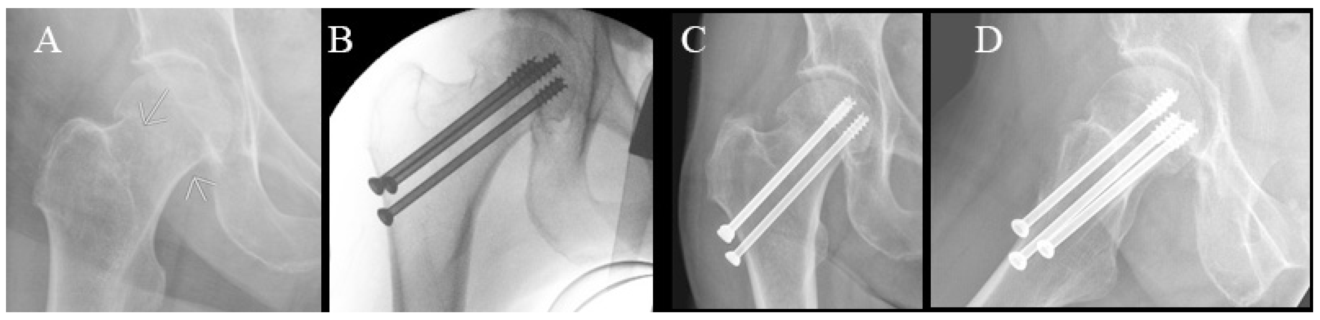 Surgeries 04 00048 g005