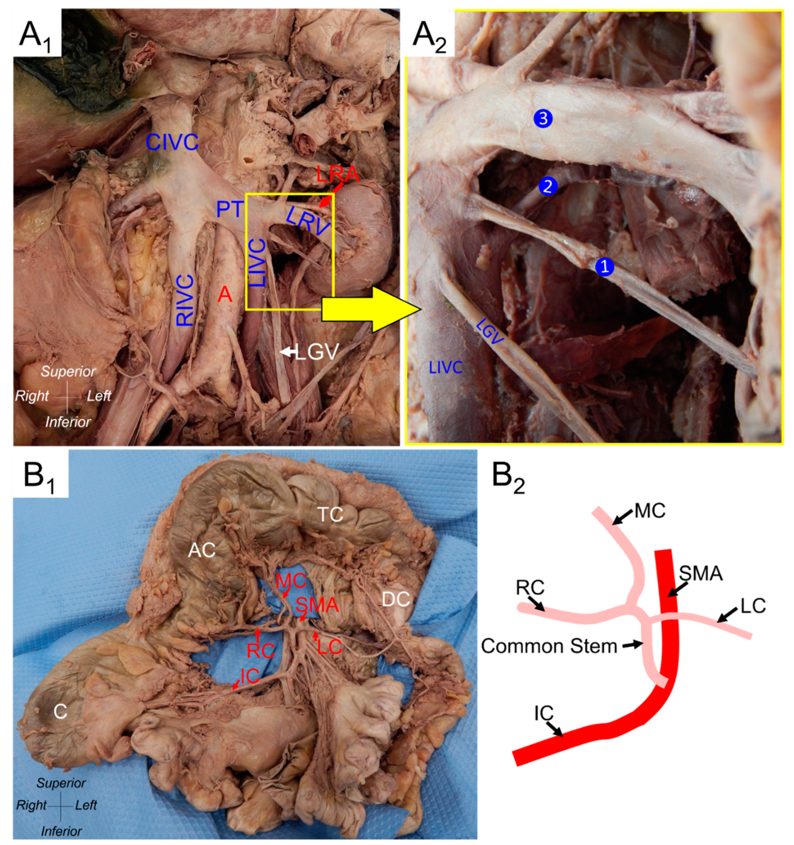 Surgeries 05 00003 g001