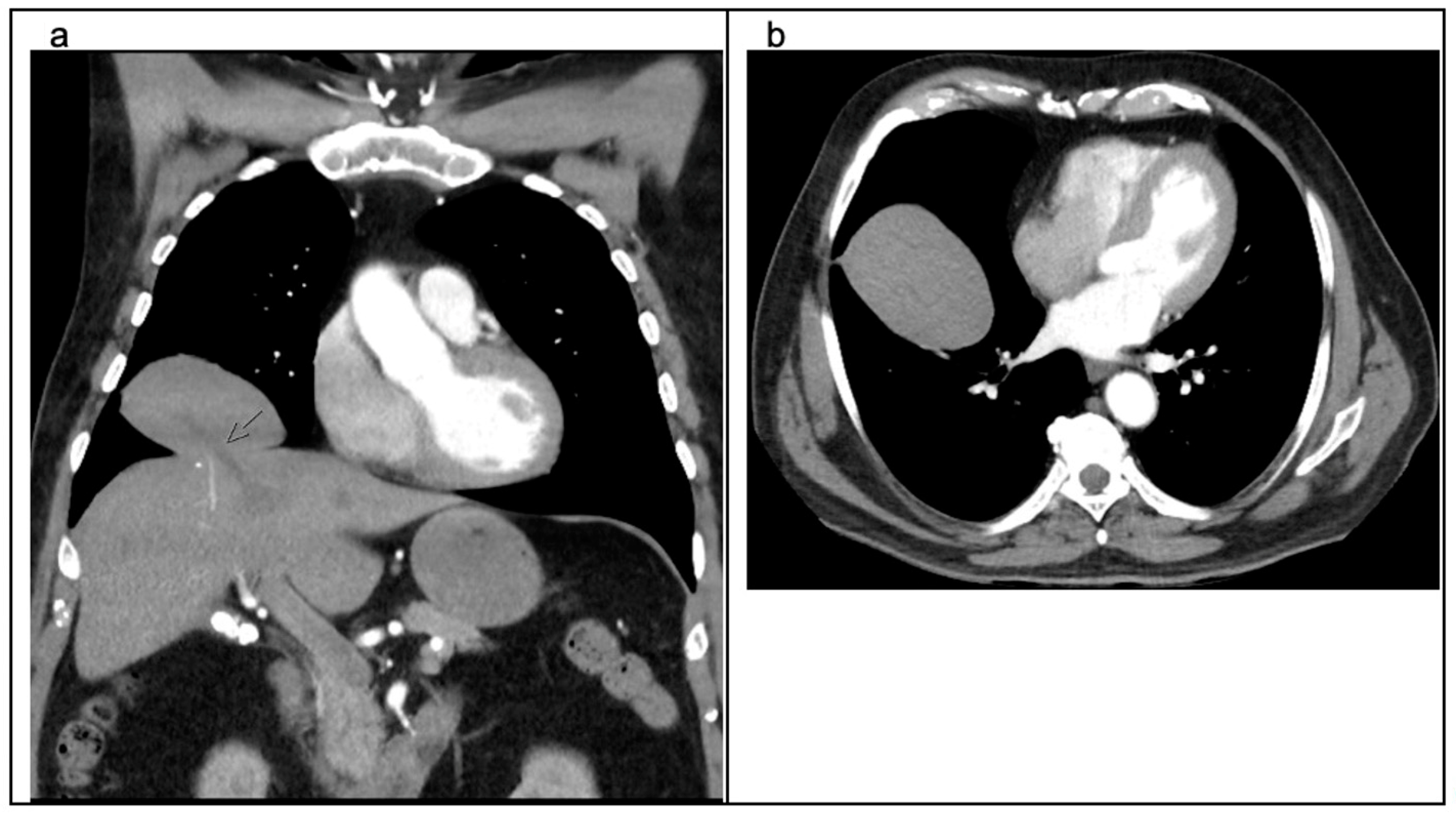 Surgeries 05 00010 g001