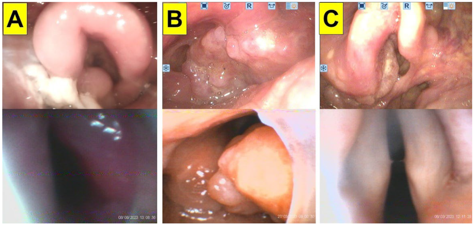 Surgeries 05 00015 g004