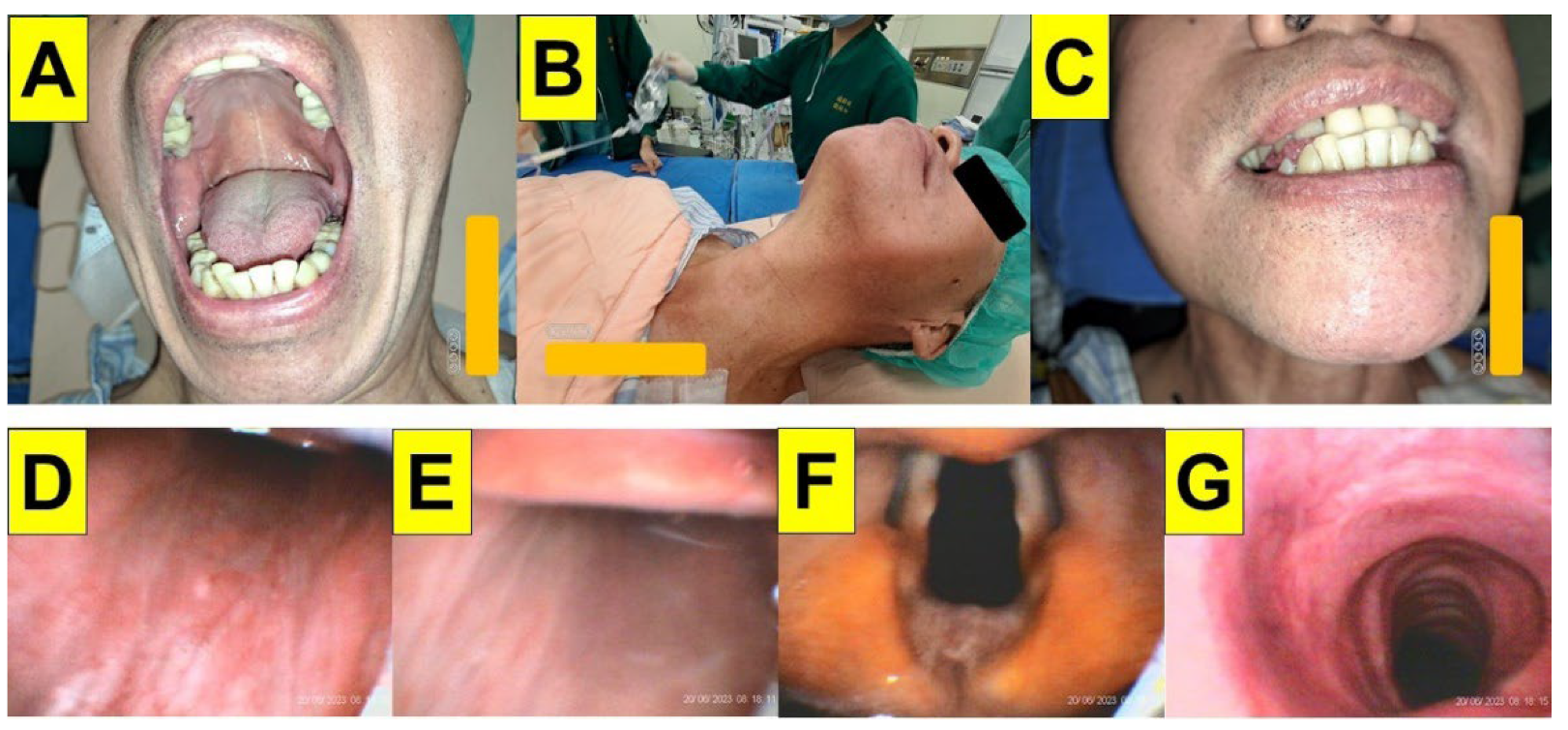 Surgeries 05 00015 g006