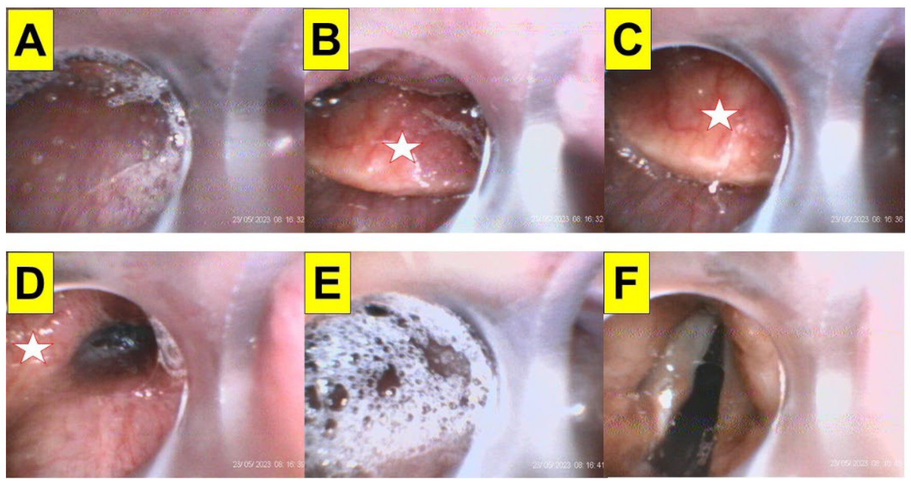 Surgeries 05 00015 g007