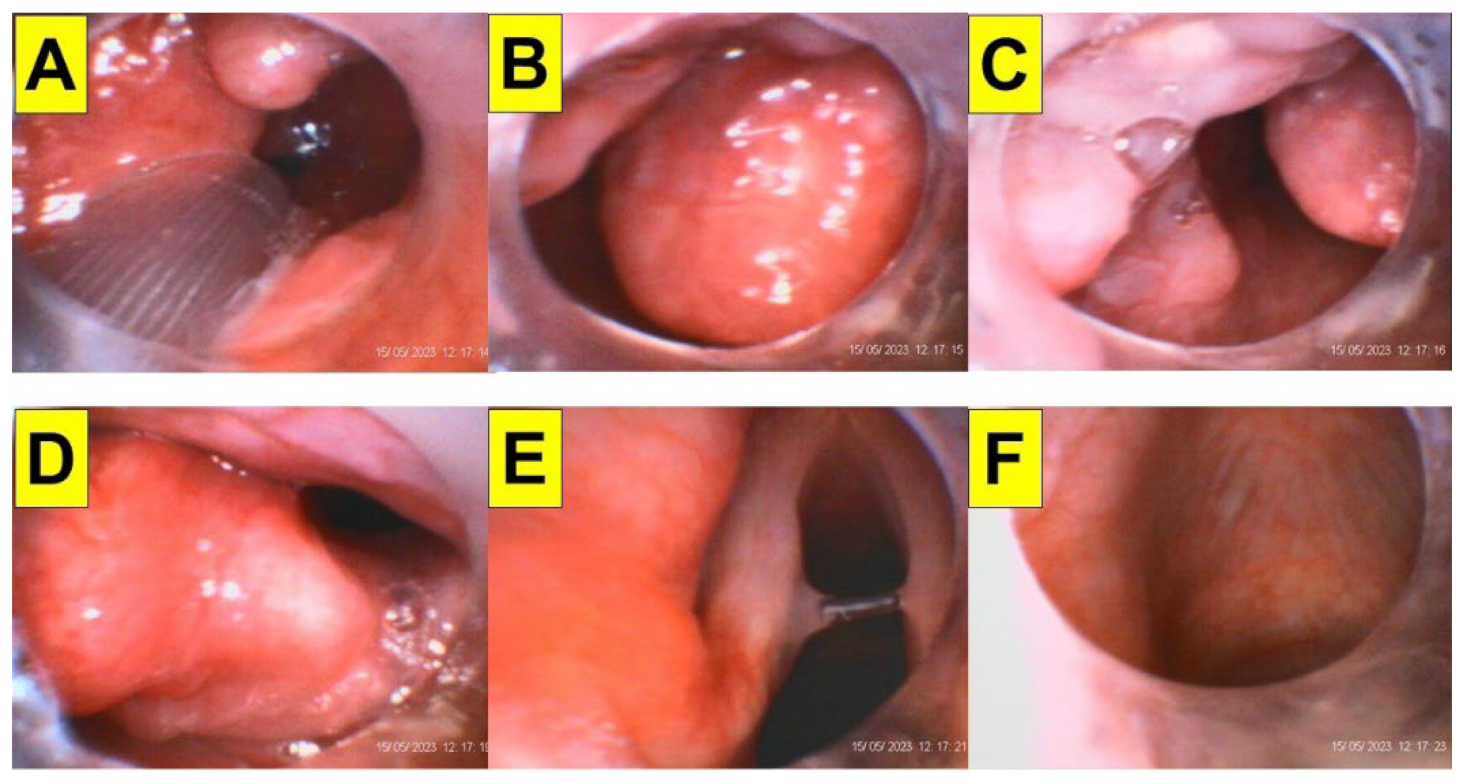 Surgeries 05 00015 g010